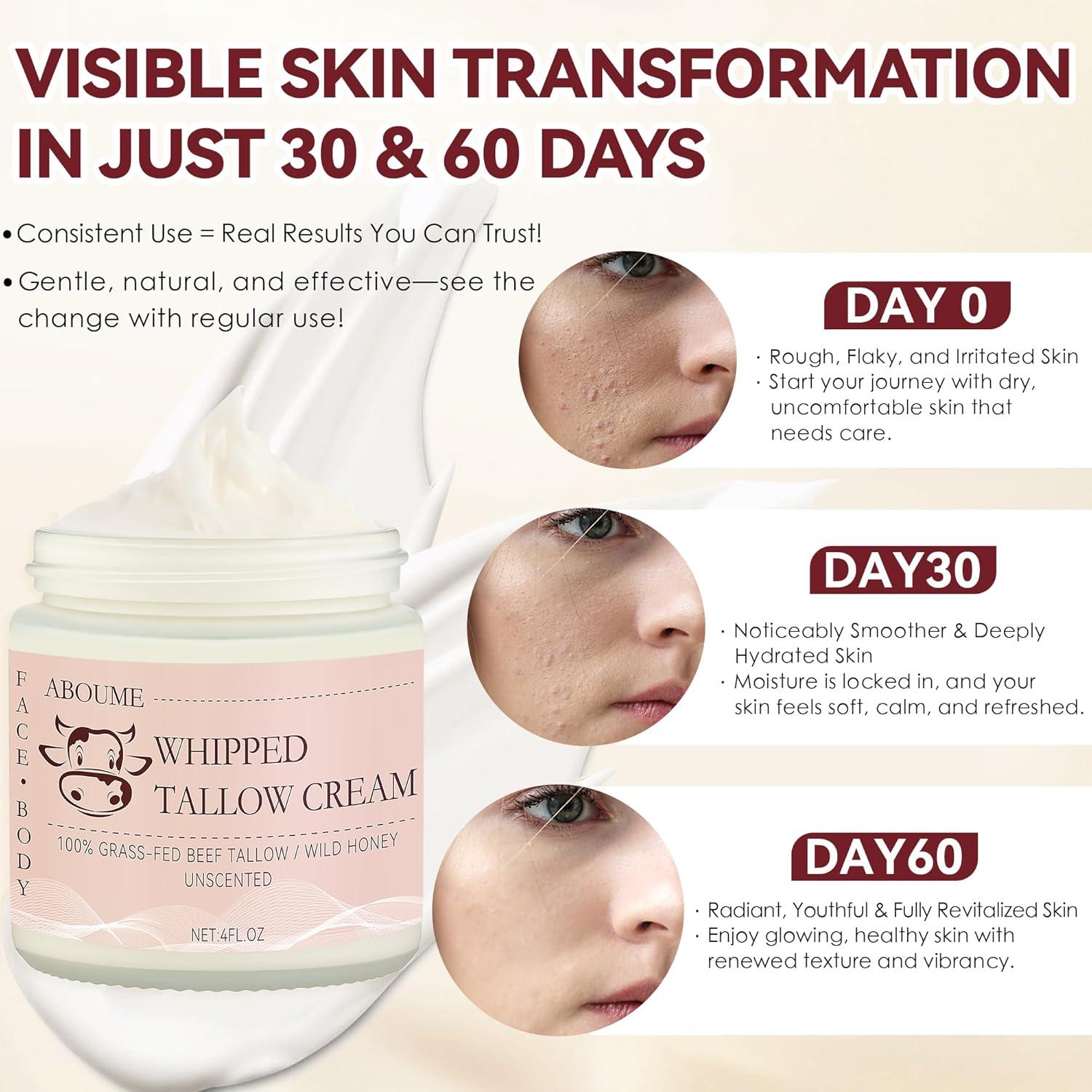 Grasa de Res Hidratante ABOUME 118.3 ML Piel Sensible