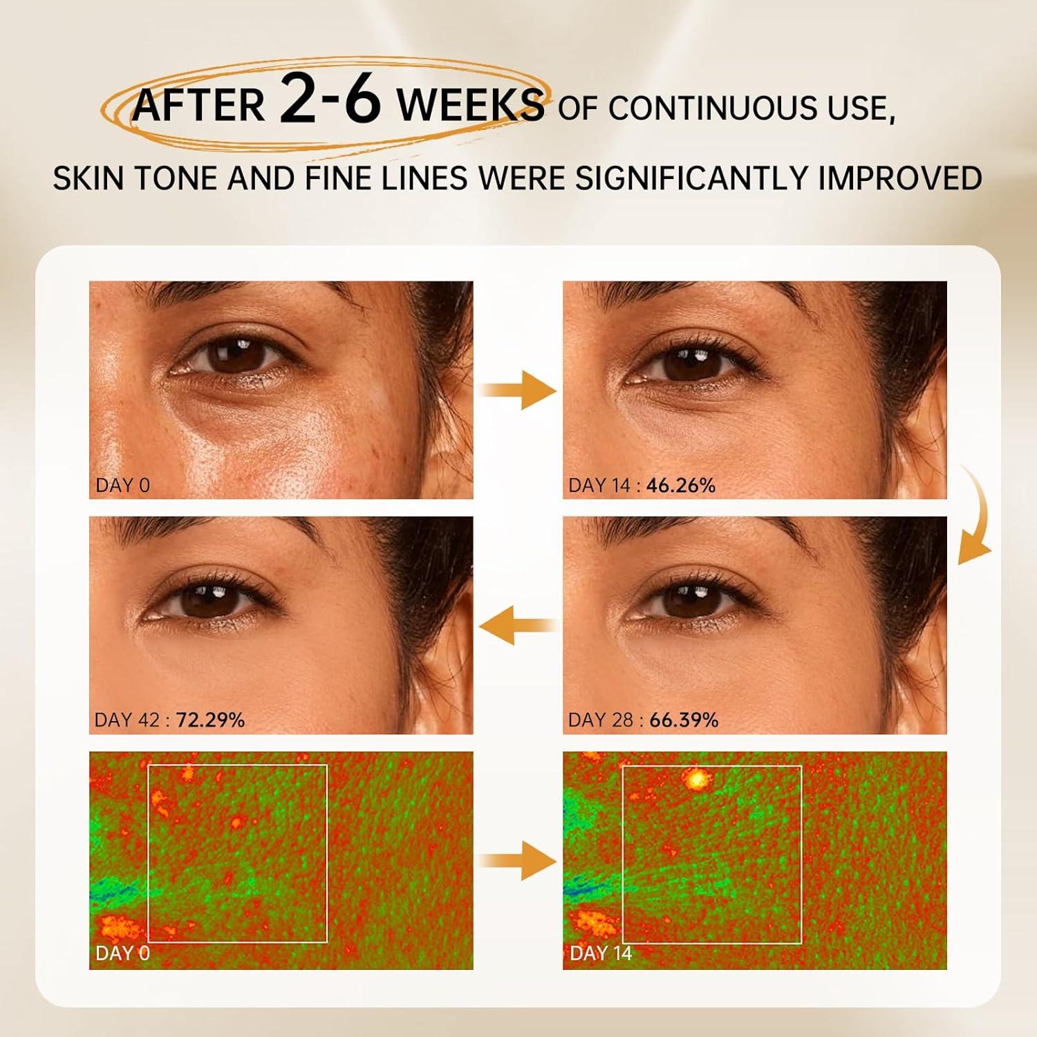 Suero Antienvejecimiento VGO con 1% Retinol y 3% Niacinamida 30 ml