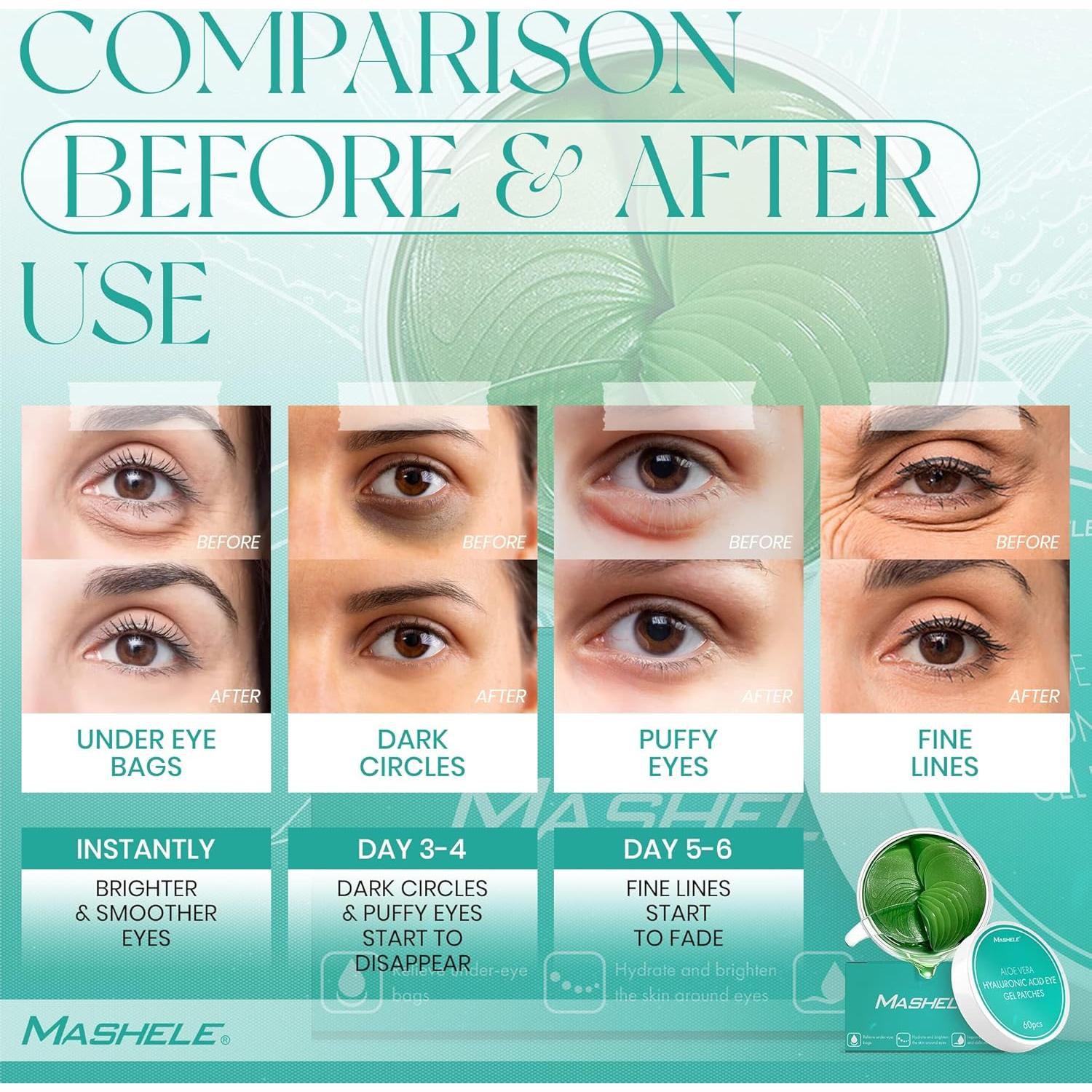 Mascarillas de Gel para Ojos MASHELE con Colágeno y Aloe Vera - 60 Pcs