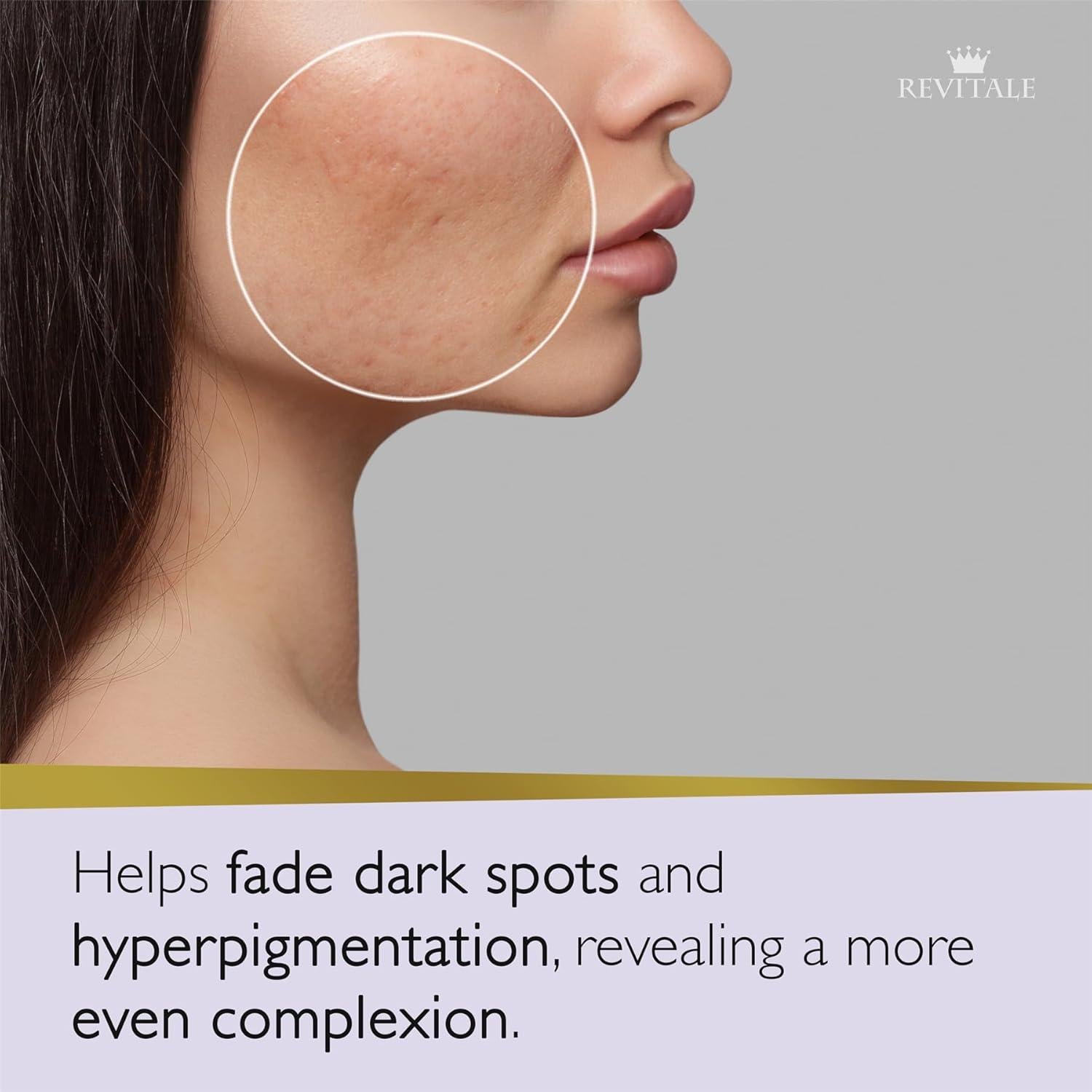 Jabón Avanzado Revitale Ácido Azelaico 80g Niacinamida