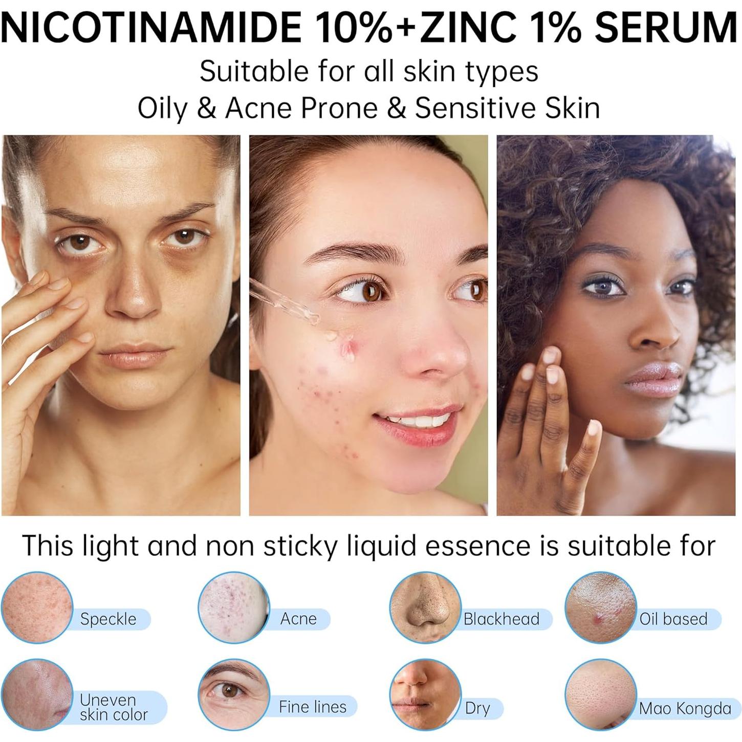 Suero de Niacinamida 10% + Zinc 1% CHANGARLOAD 30ml