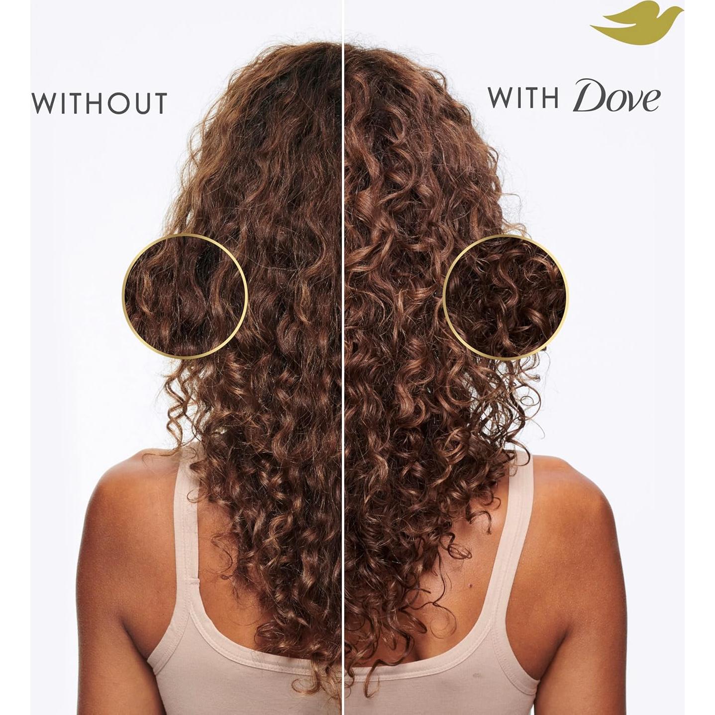 Champú Dove Derma Sequedad + Picazón 354 ml - Cuero Cabelludo Saludable