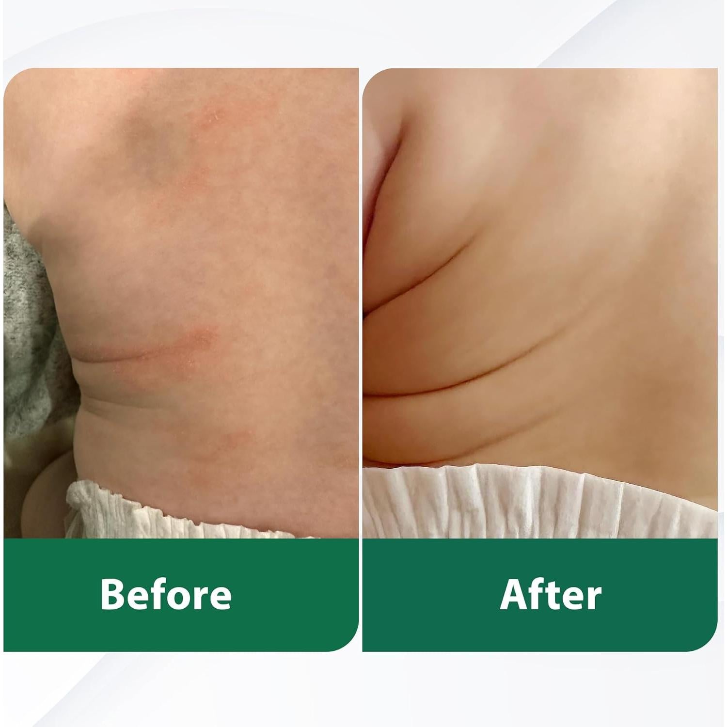 Bálsamo Hidratante de Tallow y Miel de Manuka 108g