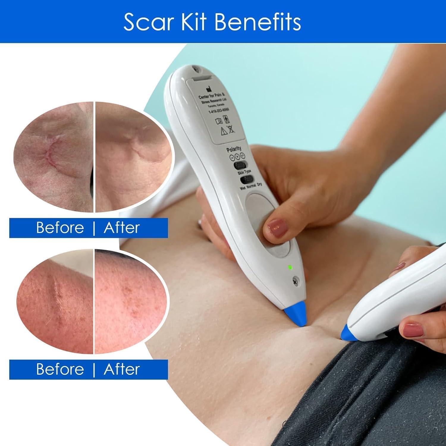 Bolígrafo Acupuntura Electrónica Dolphin Neurostim Doble