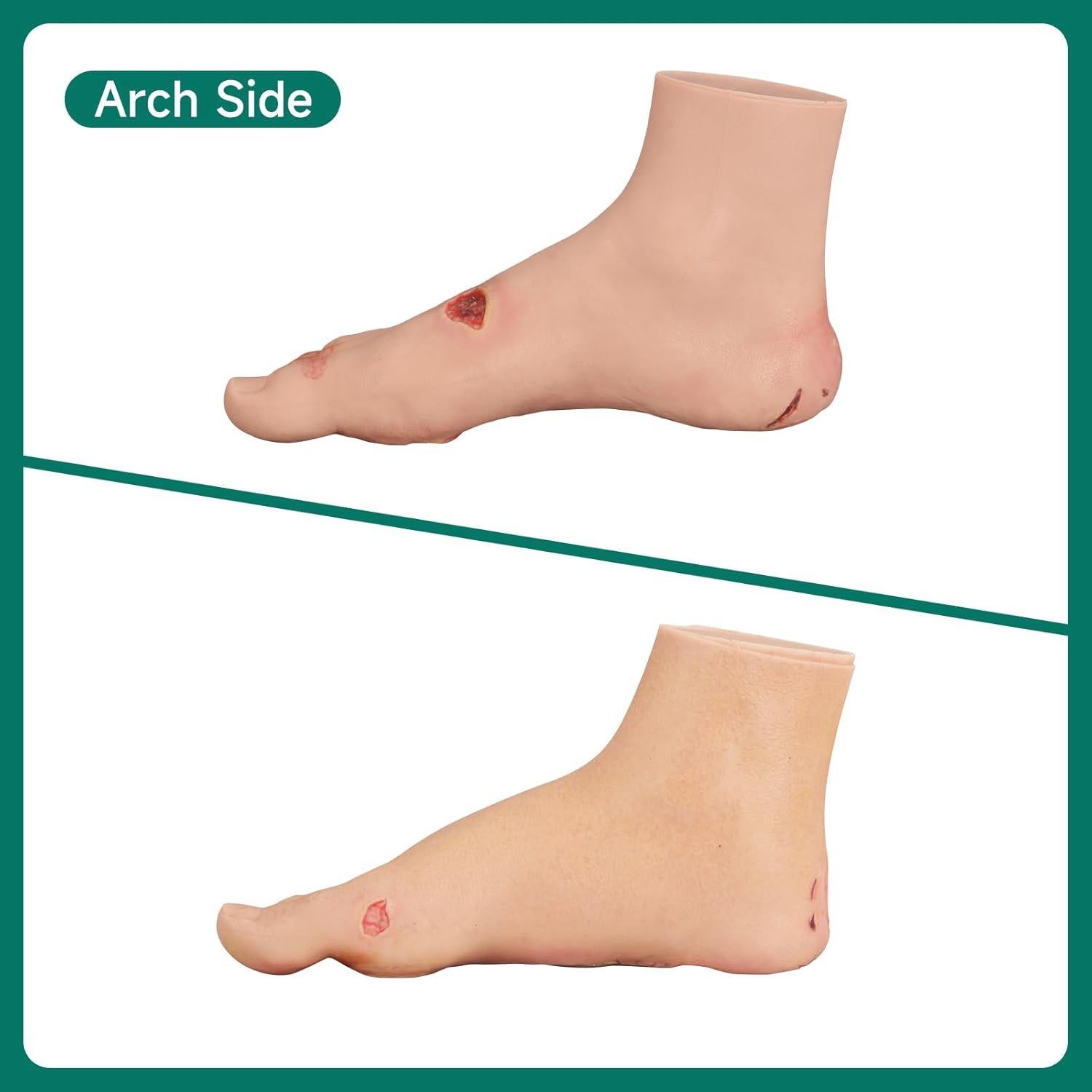 Conjunto de Ulcera Diabética Ultrassist - Modelo Clínico Preciso