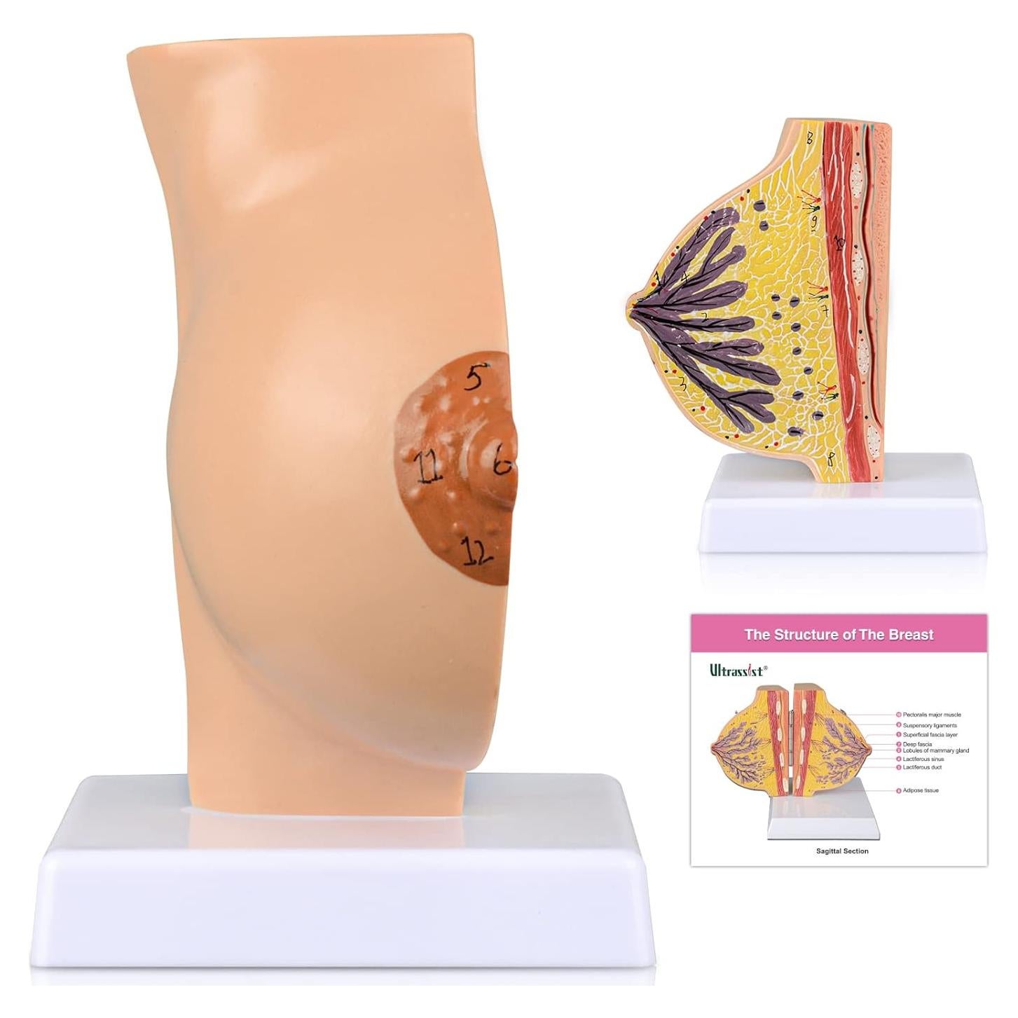 Modelo Anatómico de Mama No Lactante Ultrassist con Tarjeta de Estudio
