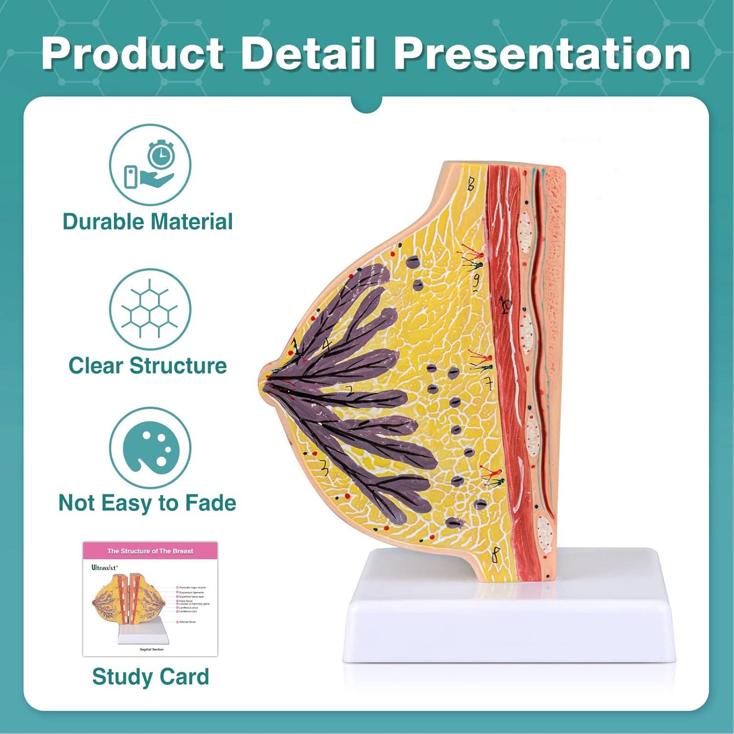 Modelo Anatómico de Mama No Lactante Ultrassist con Tarjeta de Estudio