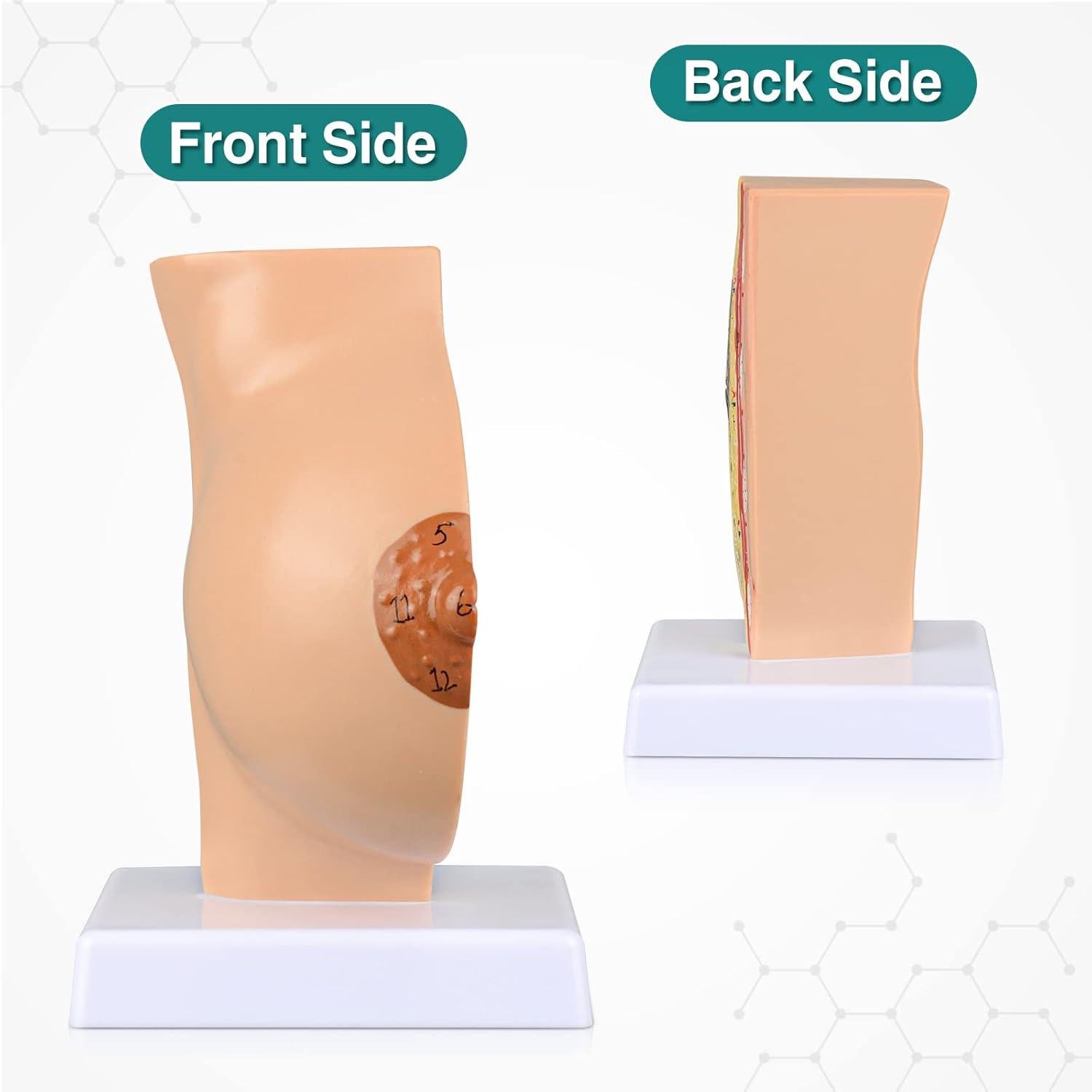 Modelo Anatómico de Mama No Lactante Ultrassist con Tarjeta de Estudio