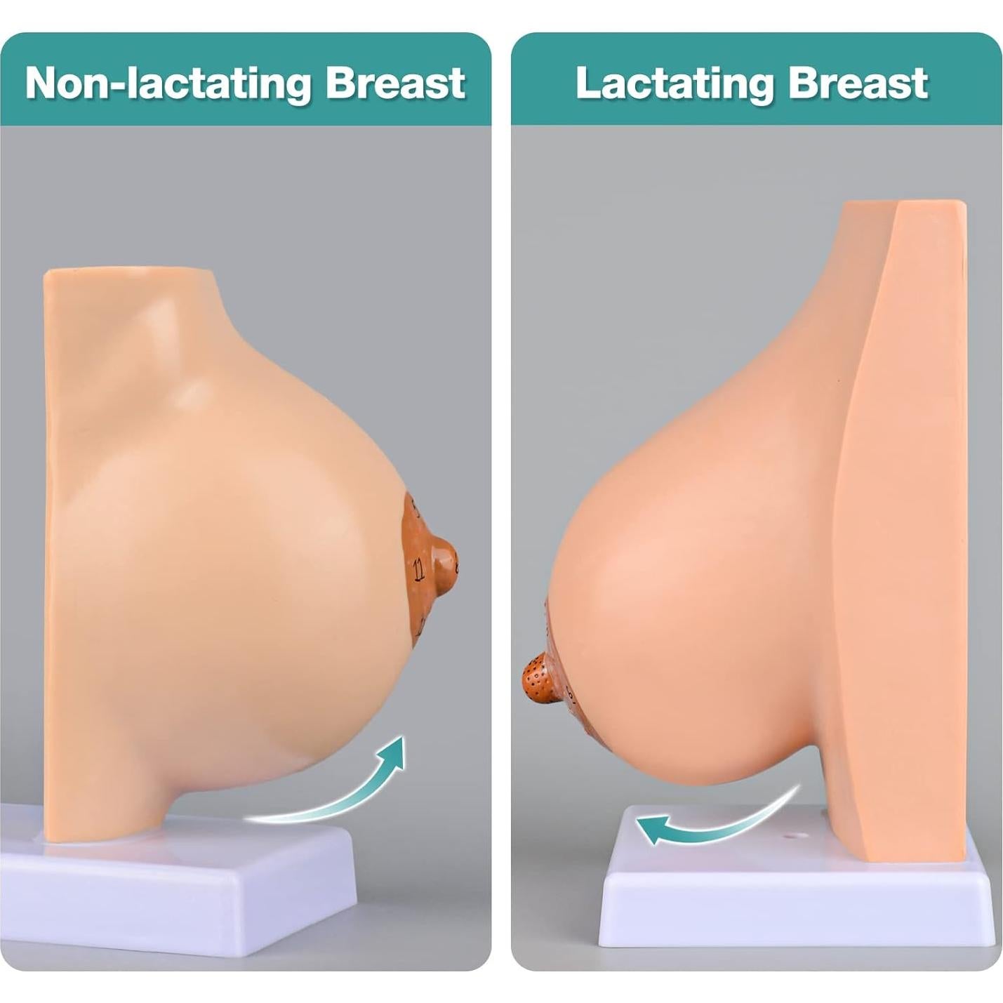 Modelo Anatómico de Mama No Lactante Ultrassist con Tarjeta de Estudio