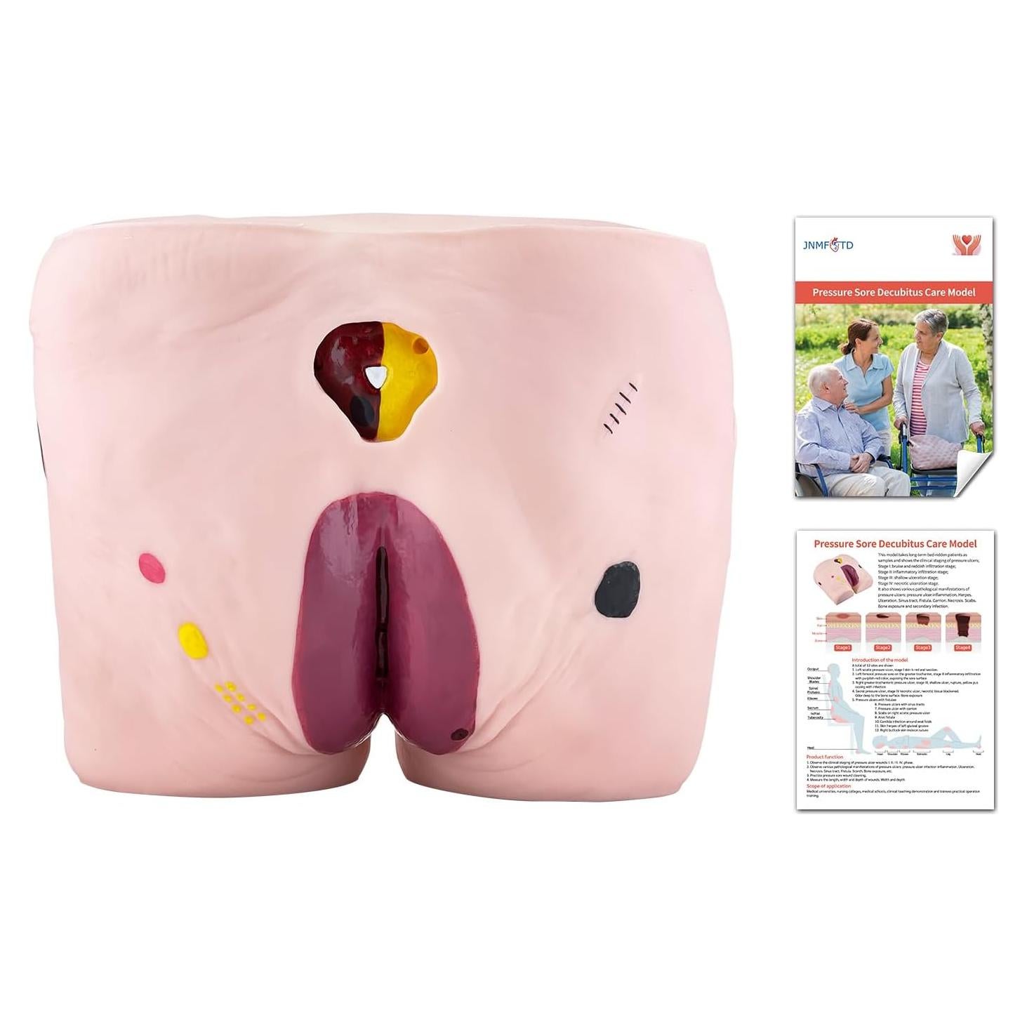 Modelo de Úlcera por Decúbito JNMFTD - 4 Etapas Realistas