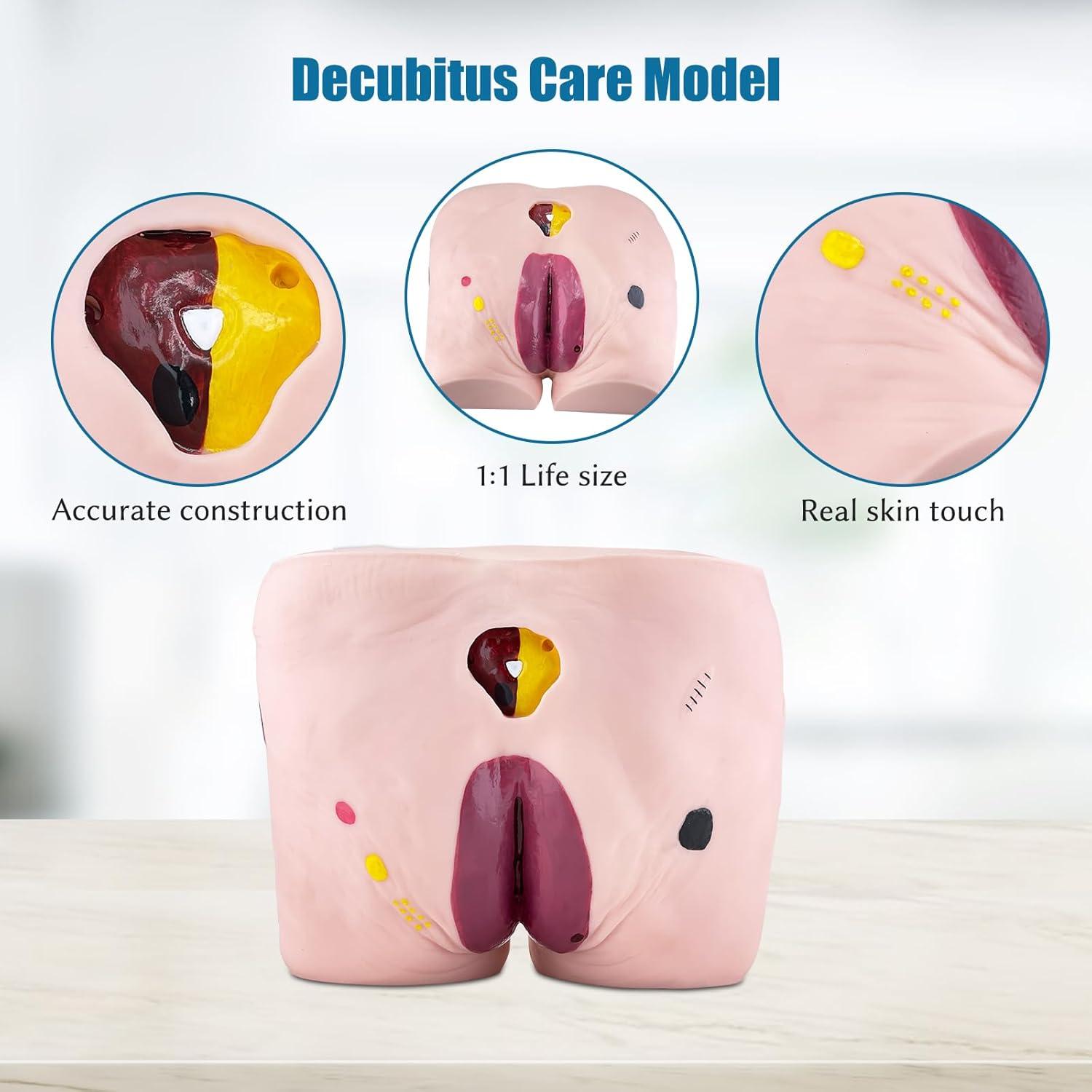 Modelo de Úlcera por Decúbito JNMFTD - 4 Etapas Realistas