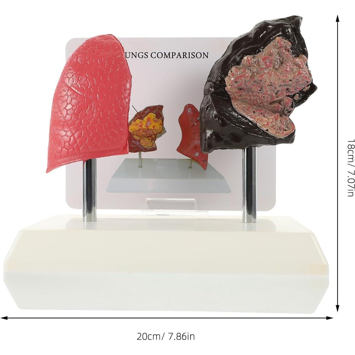 Modelo de Pulmón Fumador Cabilock - Anatomía Realista PVC 20cm