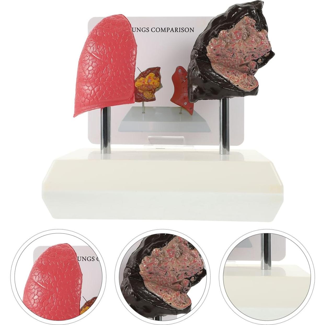 Modelo de Pulmón Fumador Cabilock - Anatomía Realista PVC 20cm