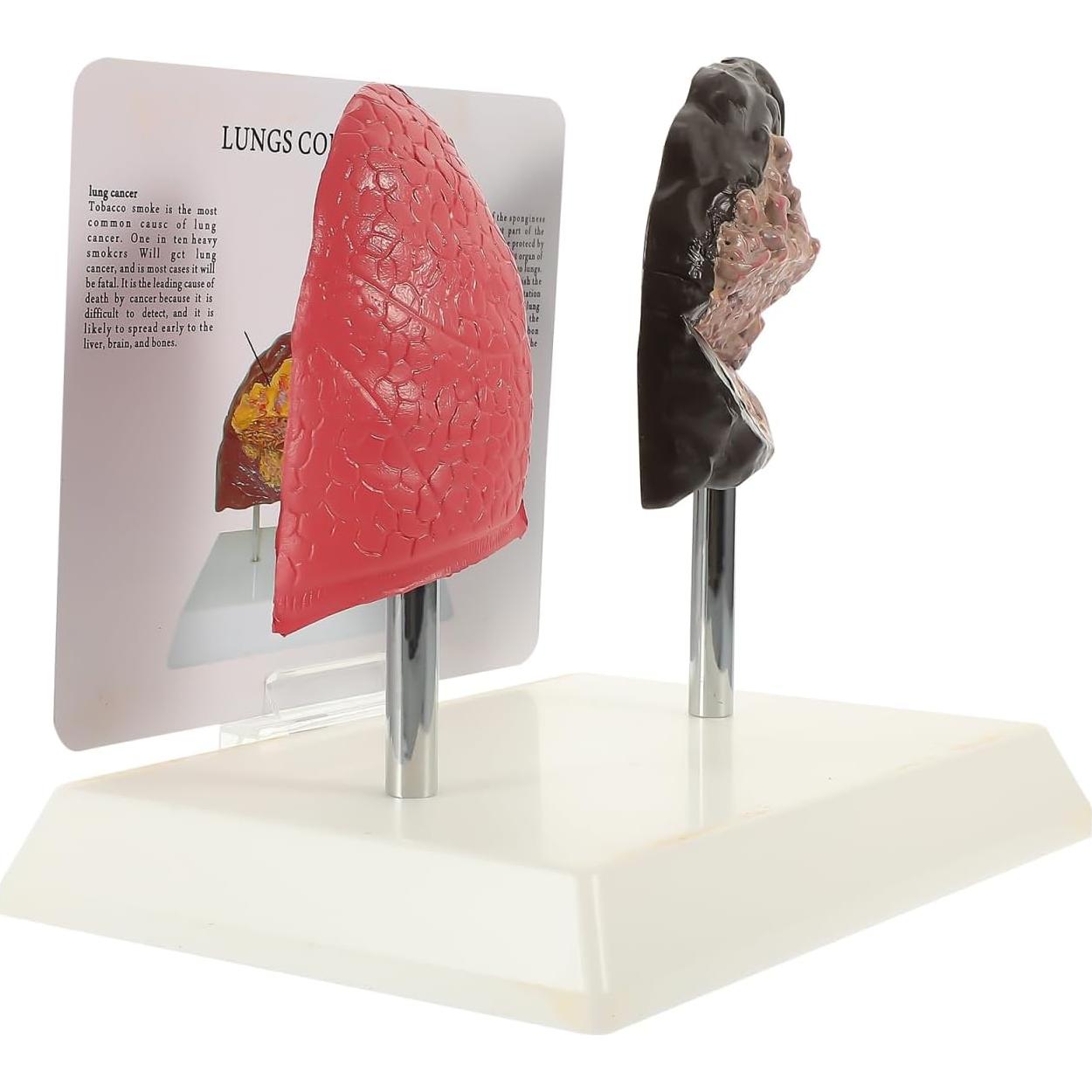 Modelo de Pulmón Fumador Cabilock - Anatomía Realista PVC 20cm