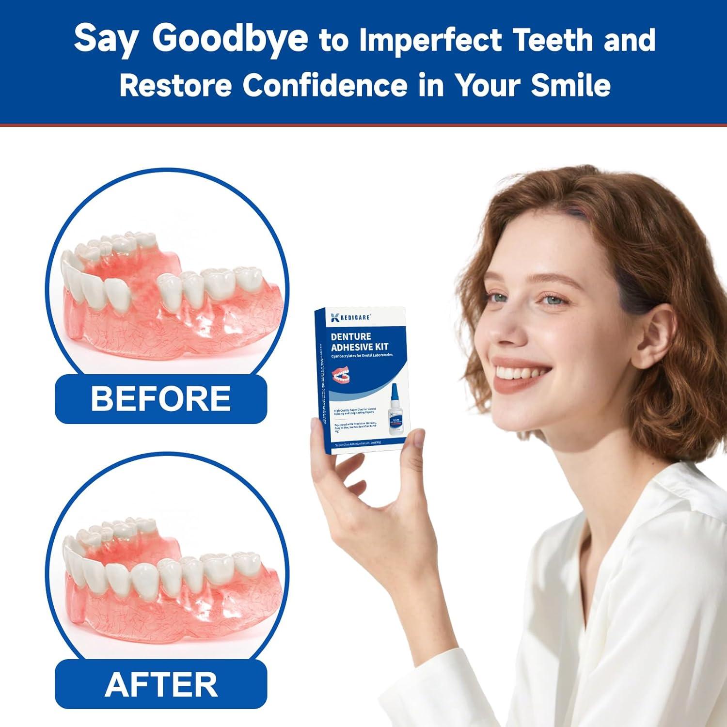 Kit de Pegamento para Reparación de Dentaduras Kedicare 30g