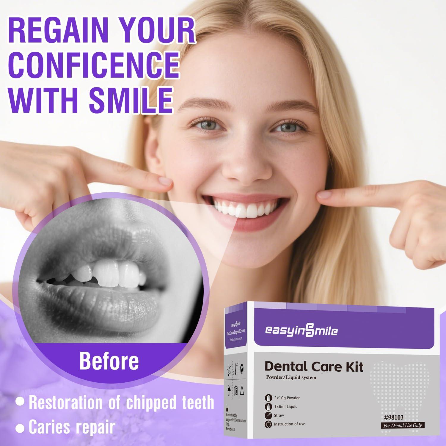 Kit de Reparación Dental Temporal Jinestune 10g x2 + 6ml