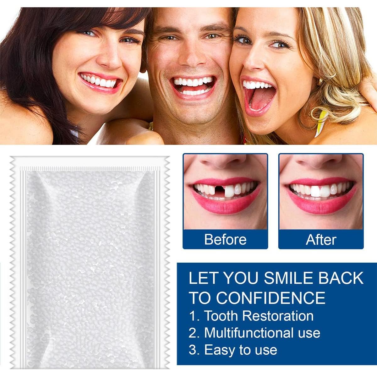 Kit de Reparación Dental Ceonam - 100g Perlas Ajuste Térmico