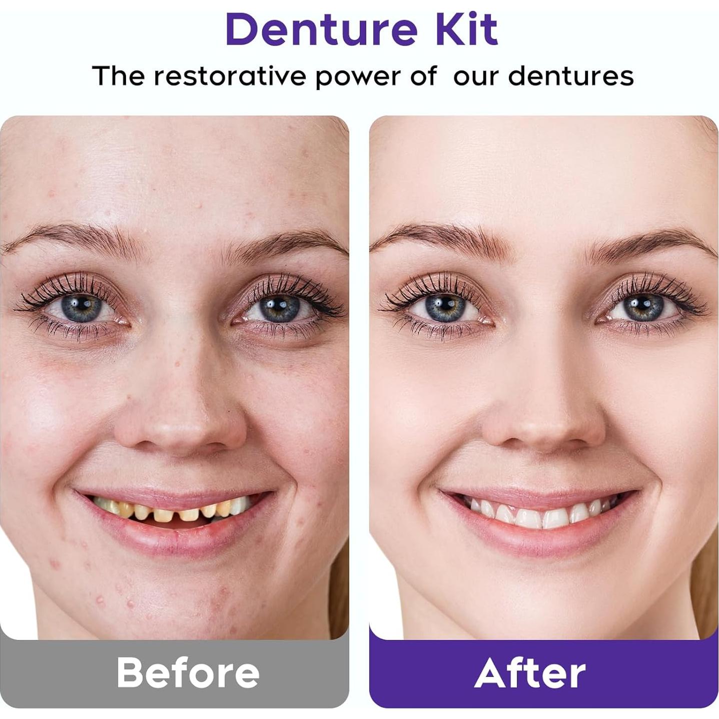 Kit de Dentaduras DIY SEAJEA - Dientes Falsos Personalizables