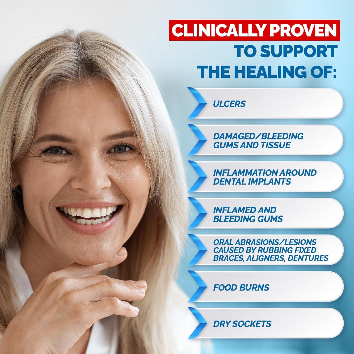 Gengigel Gel Oral 20ml - Ácido Hialurónico para Encías