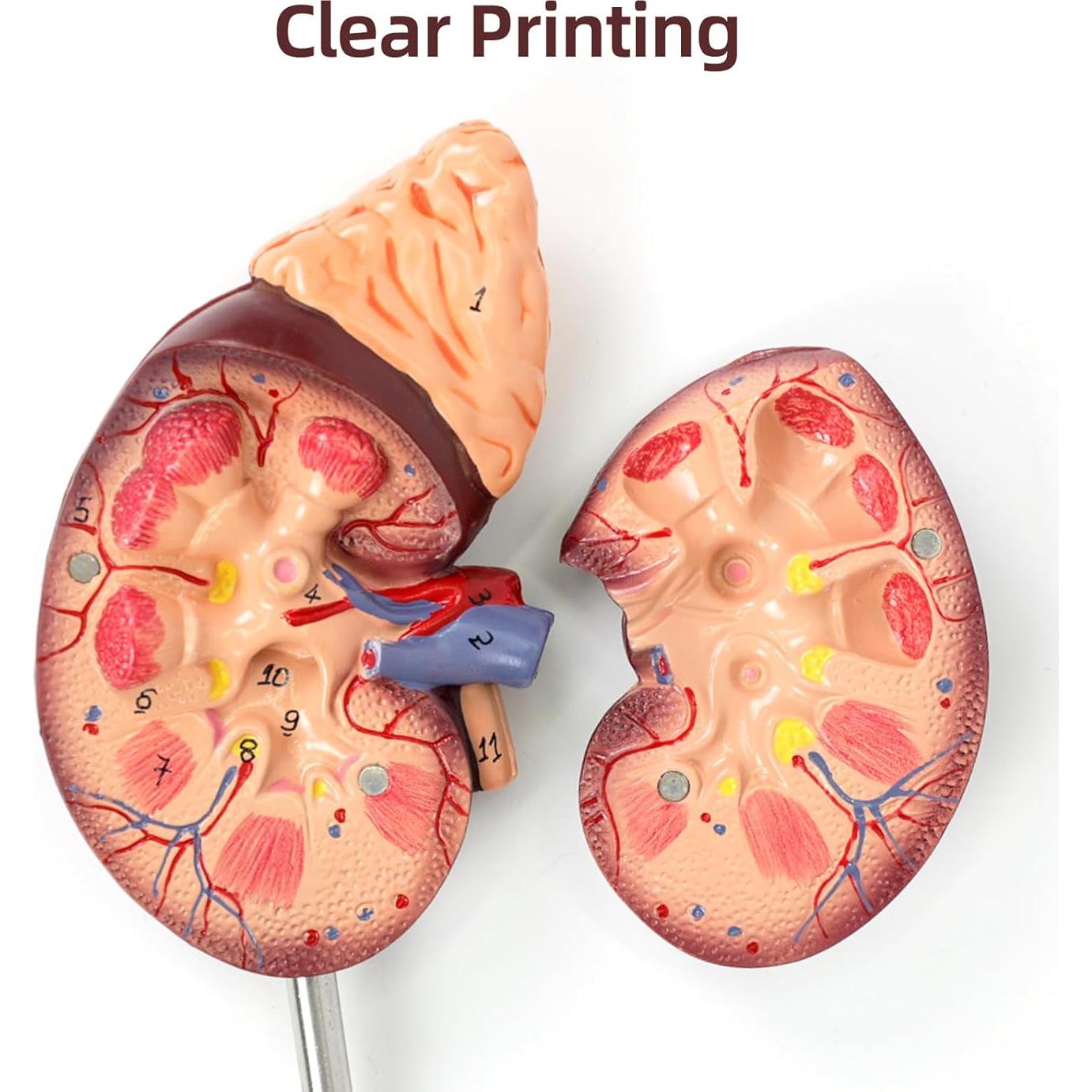 Modelo de Anatomía del Riñón Desmontable Simedutech 1:1 PVC