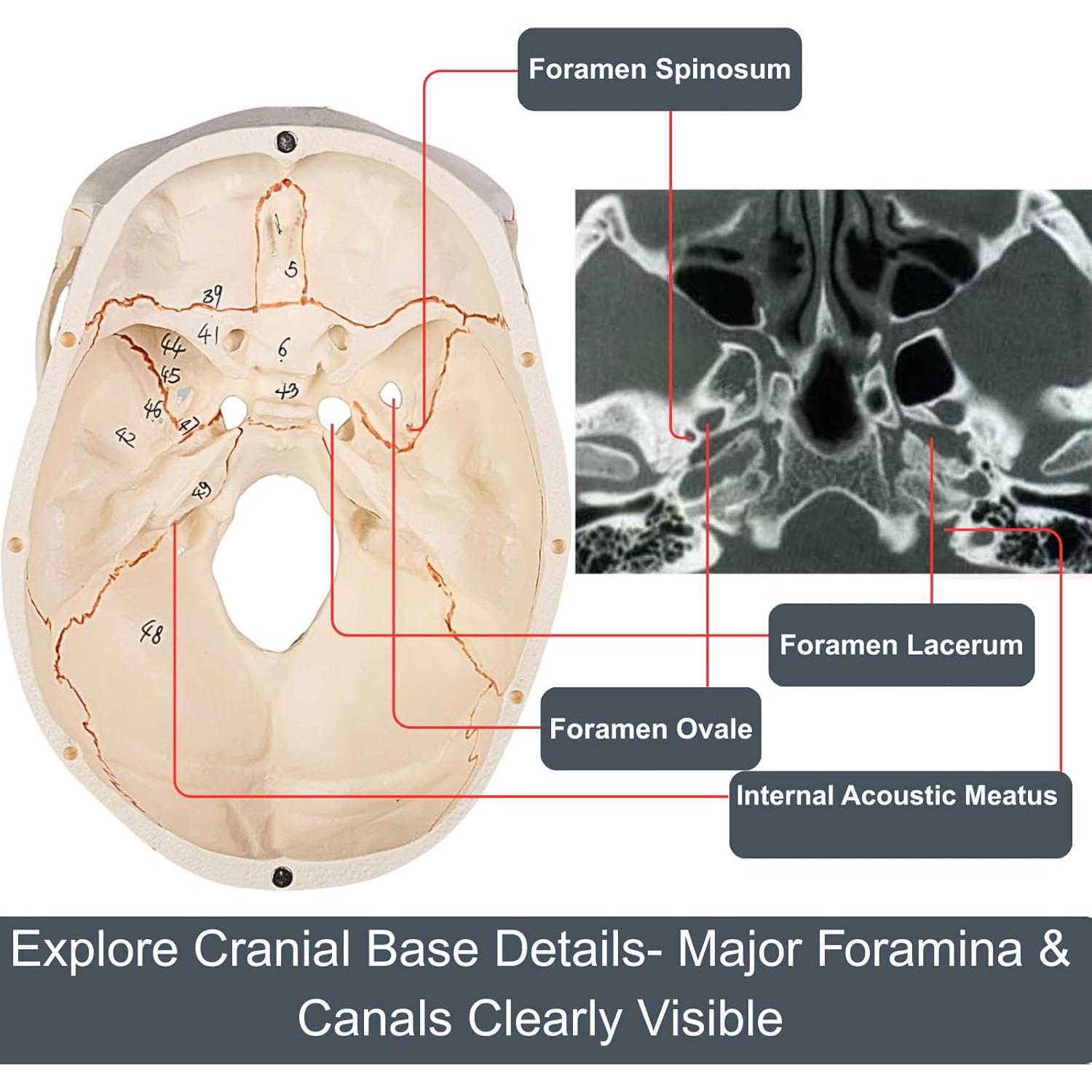 Modelo de Cráneo Humano Atolearn 1:1 con Puntero y Manual
