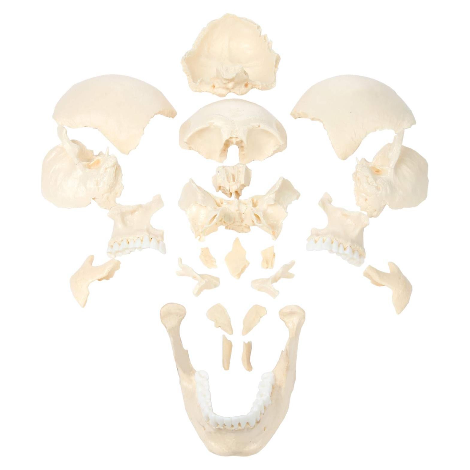 Modelo de Cráneo Humano Disarticulado Axis Scientific 22 Piezas