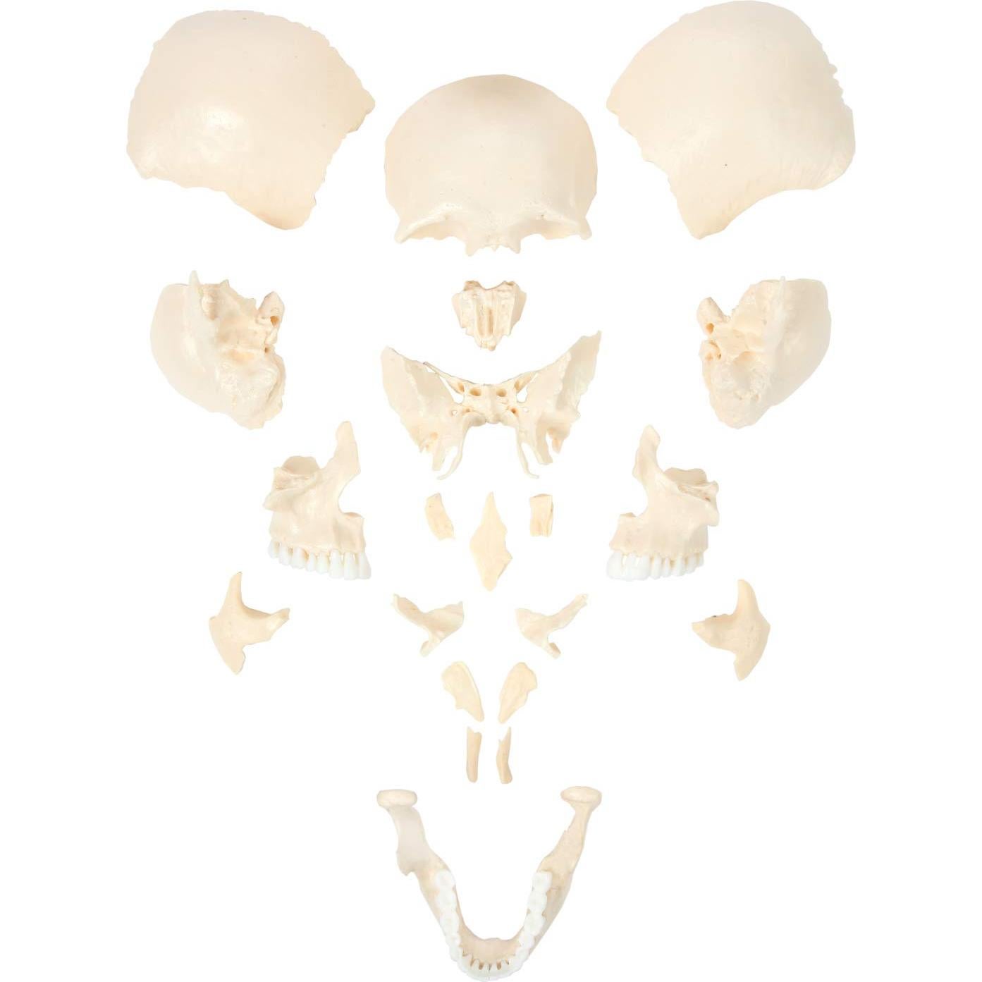 Modelo de Cráneo Humano Disarticulado Axis Scientific 22 Piezas