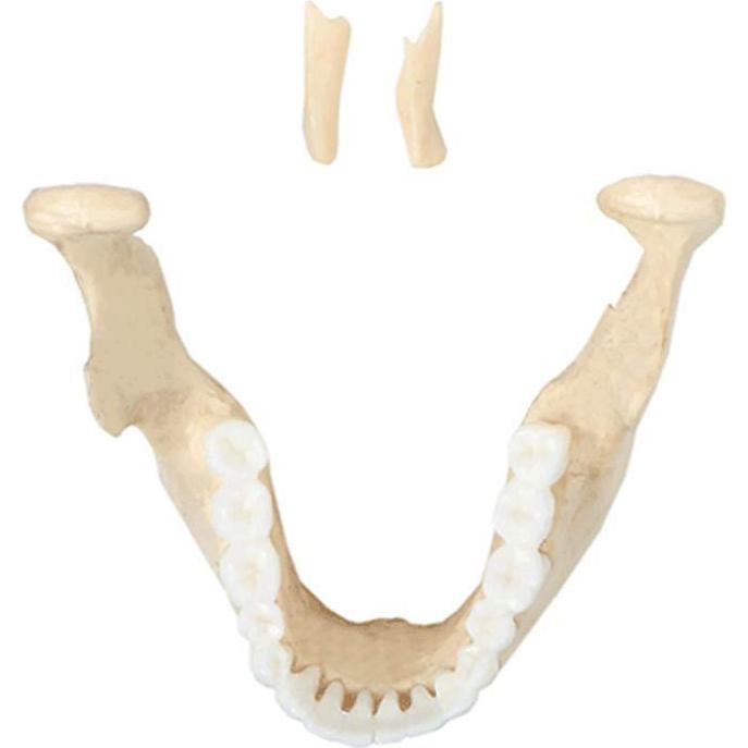 Modelo de Cráneo Humano Disarticulado Axis Scientific 22 Piezas
