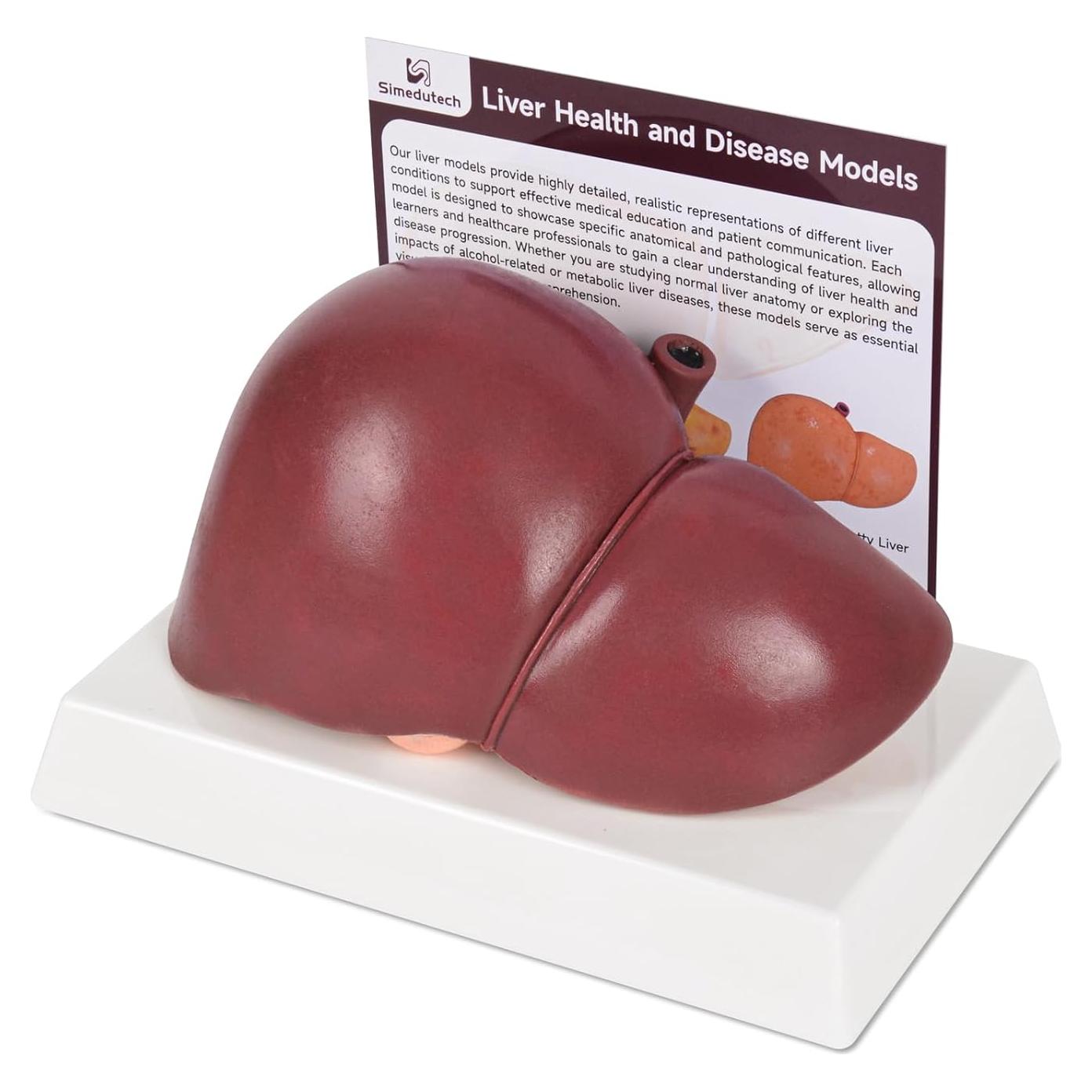 Modelo de Anatomía del Hígado Humano en Silicona 25.9x17 cm