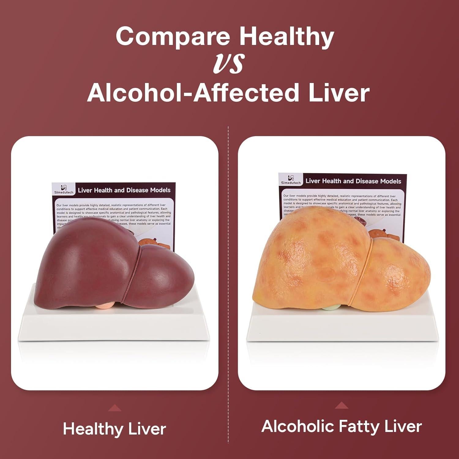 Modelo de Anatomía del Hígado Humano en Silicona 25.9x17 cm