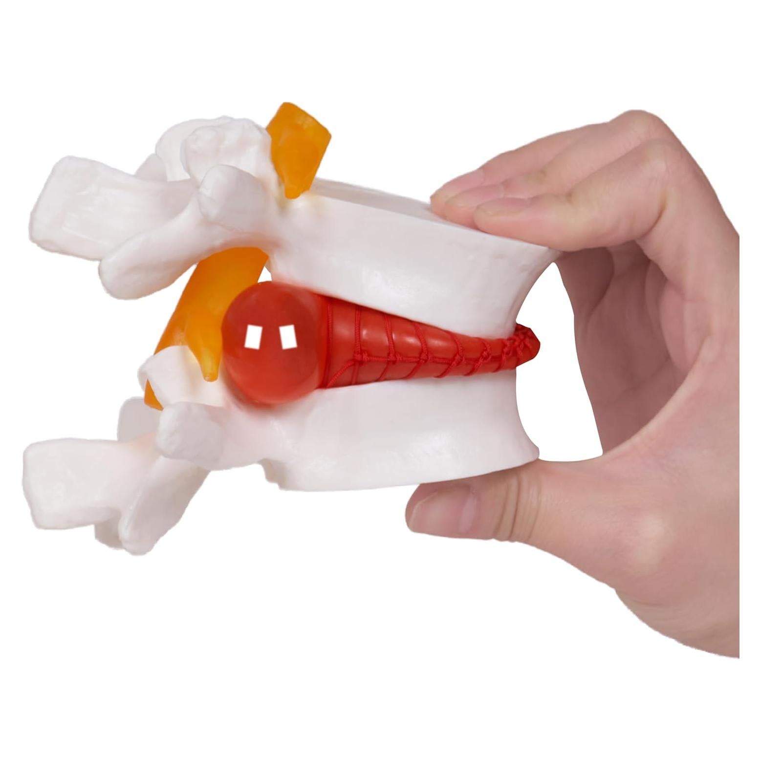 Modelo de Hernia de Disco Lumbar Breesky 1.5x Detalle