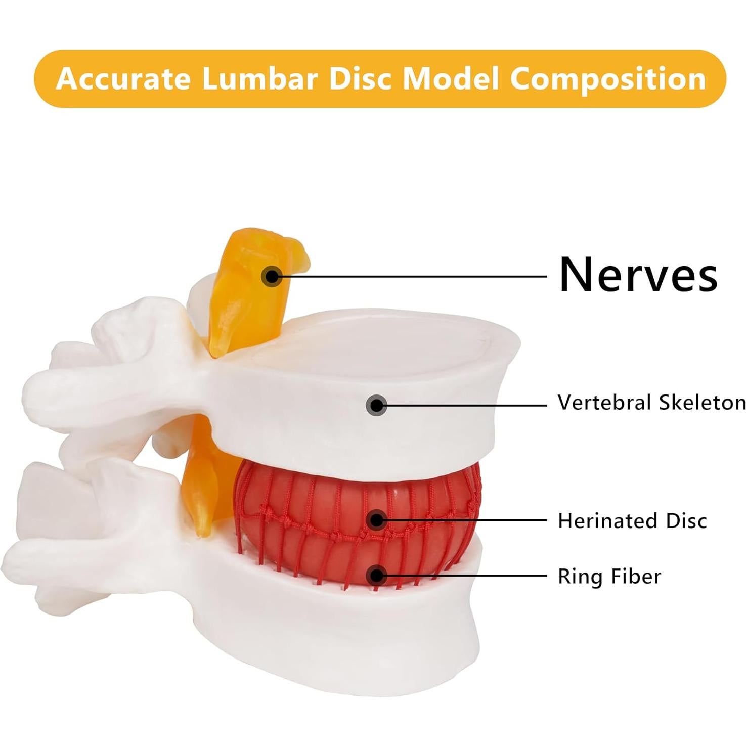 Modelo de Hernia de Disco Lumbar Breesky 1.5x Detalle