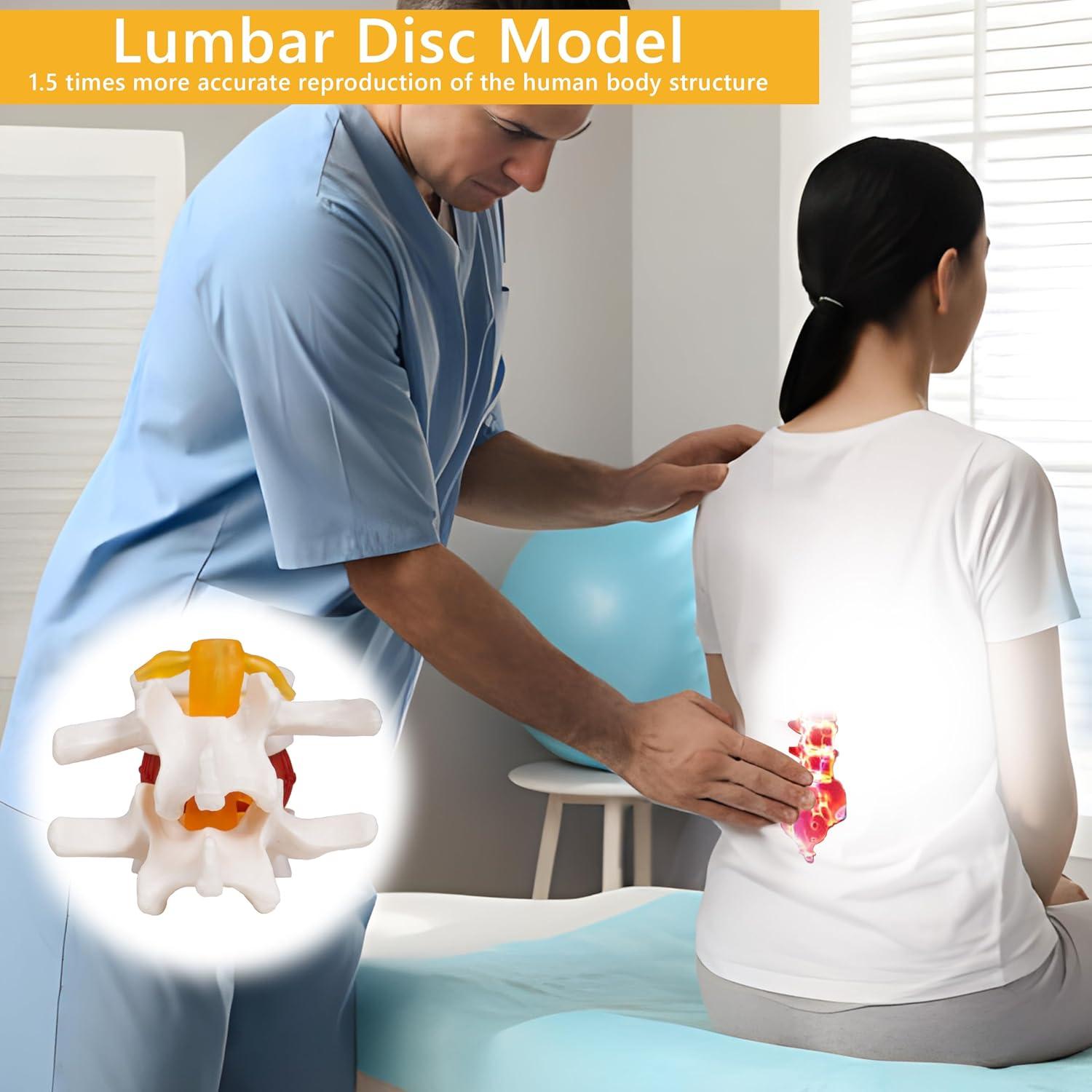 Modelo de Hernia de Disco Lumbar Breesky 1.5x Detalle