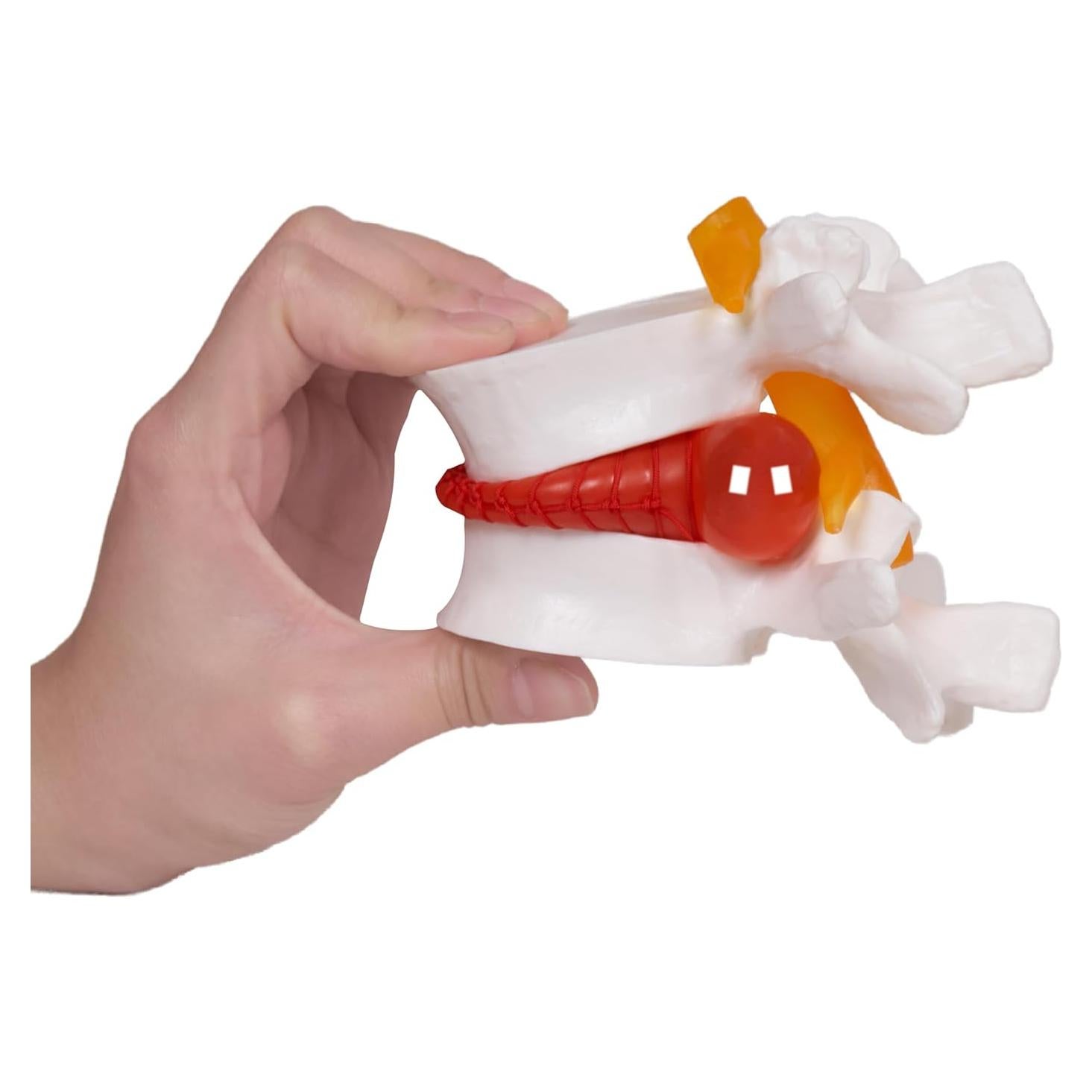 Modelo de Herniación de Disco Lumbar NLShan 1.5x Real