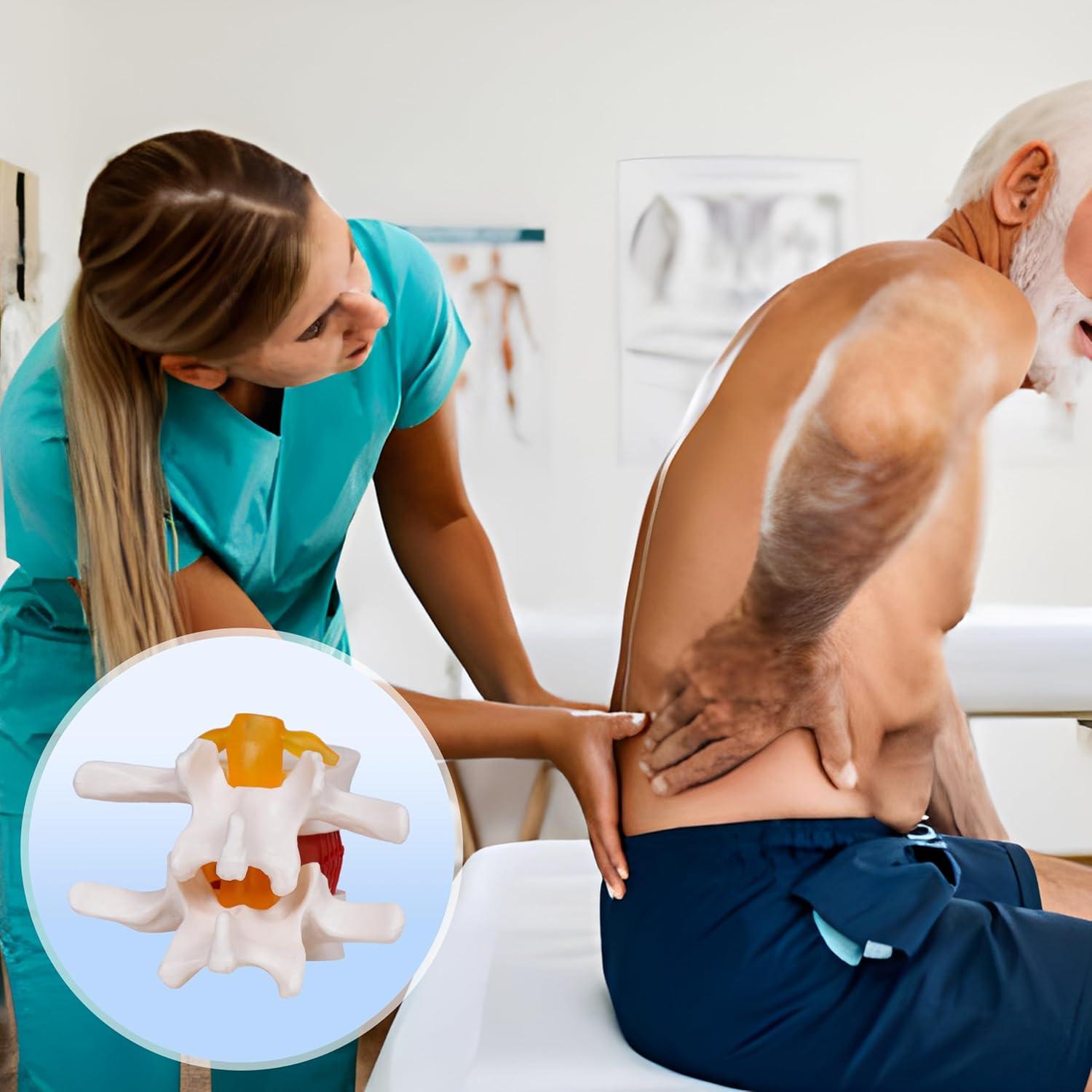 Modelo de Herniación de Disco Lumbar NLShan 1.5x Real