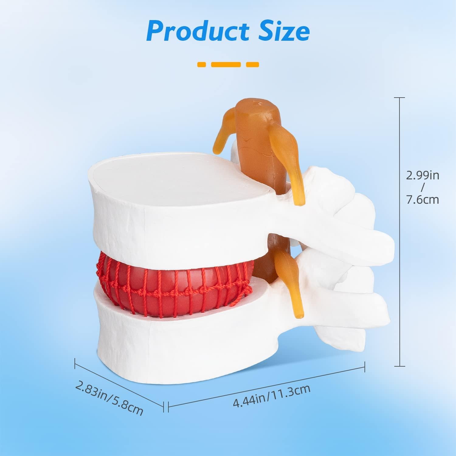 Modelo Anatómico de Herniación de Disco Lumbar 1.5X PVC