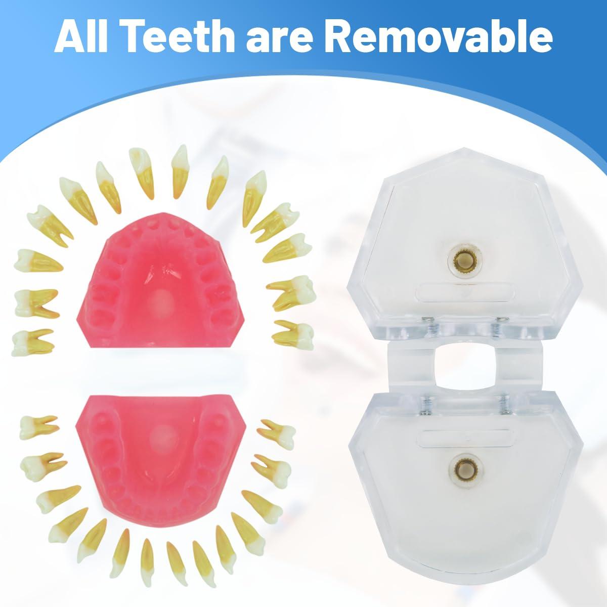 Modelo Dental Witbee con Dientes Removibles y Carcasa Transparente