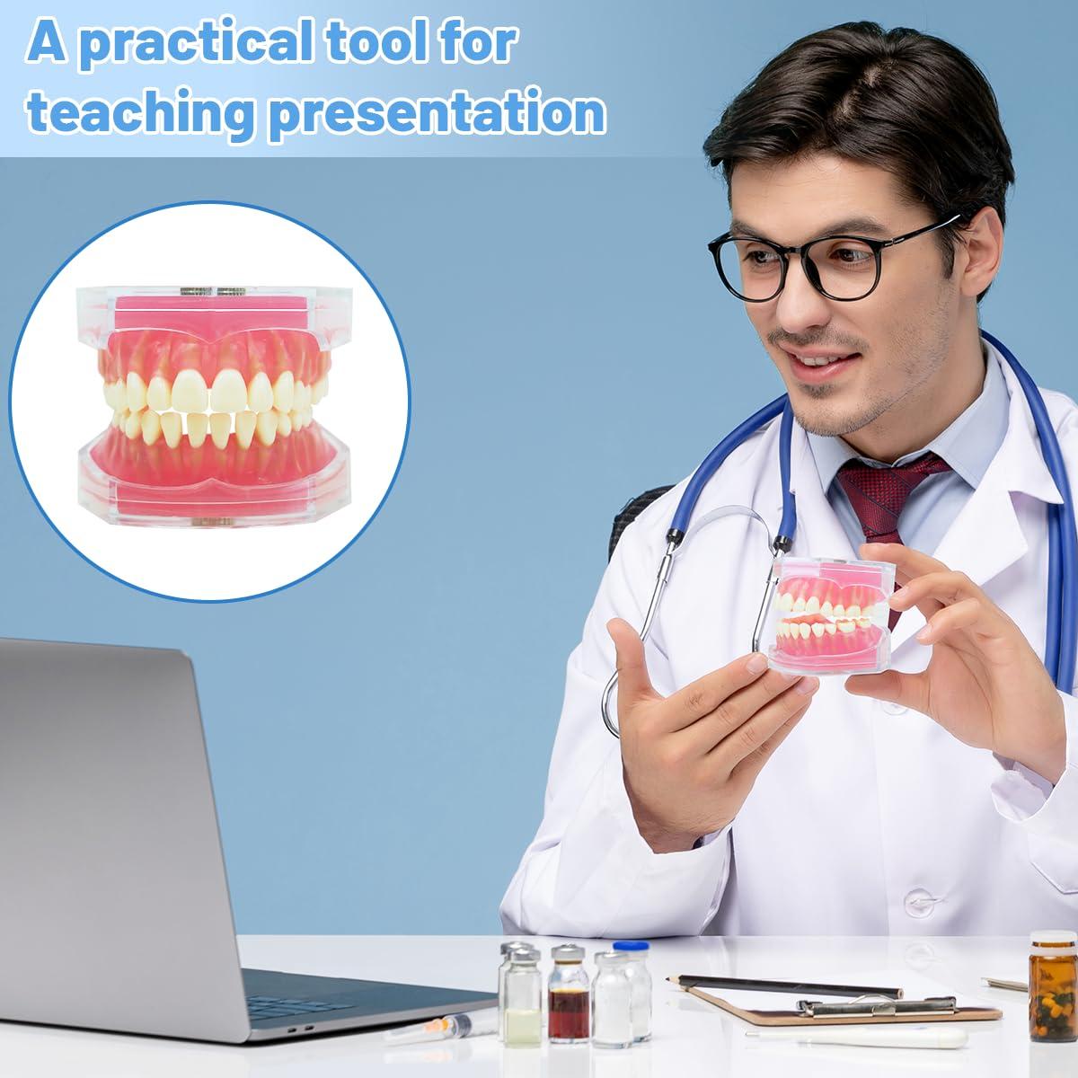 Modelo Dental Witbee con Dientes Removibles y Carcasa Transparente