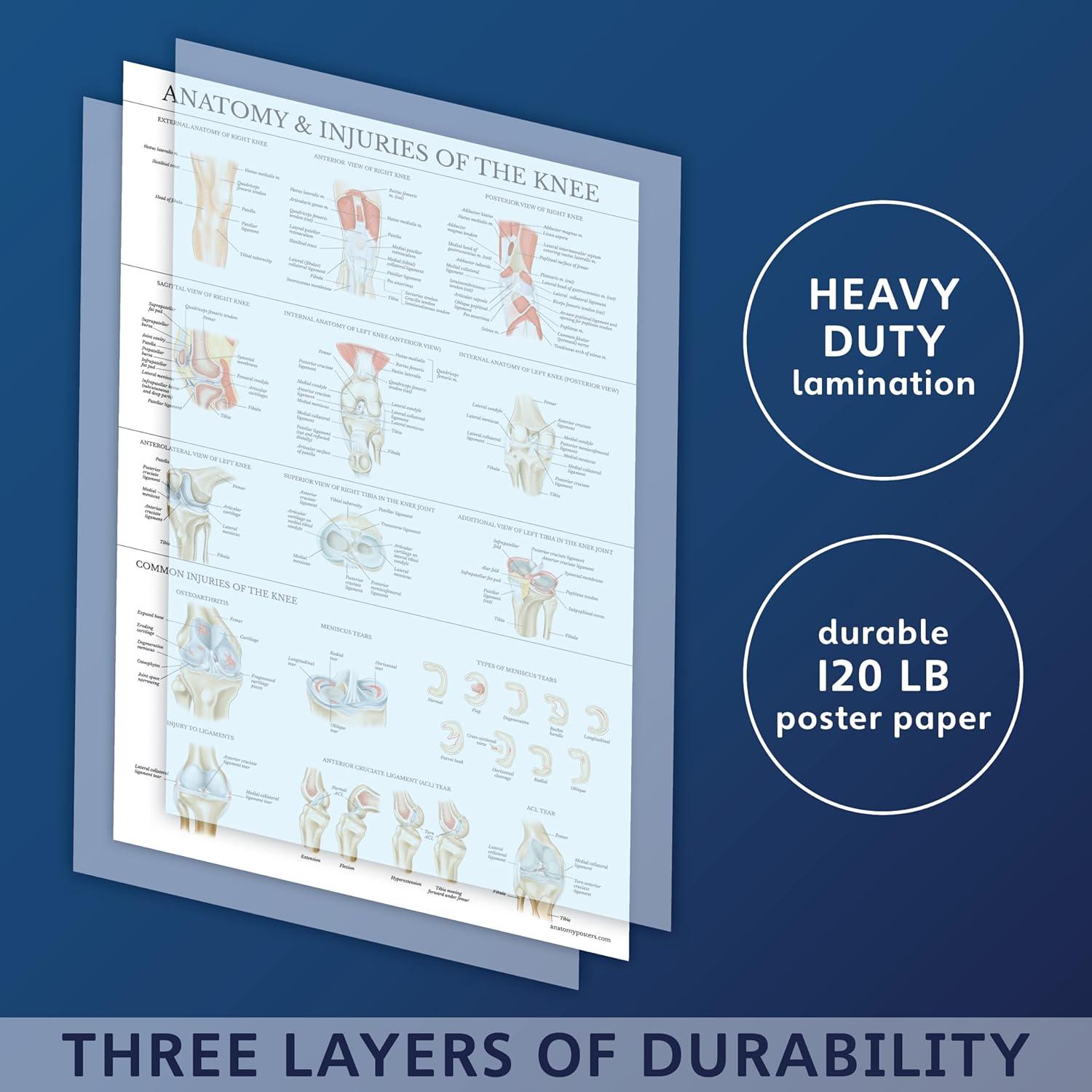 Conjunto de Pósters de Anatomía Rodilla y Cadera - Palace Learning - Laminado 68.58x45.72 cm