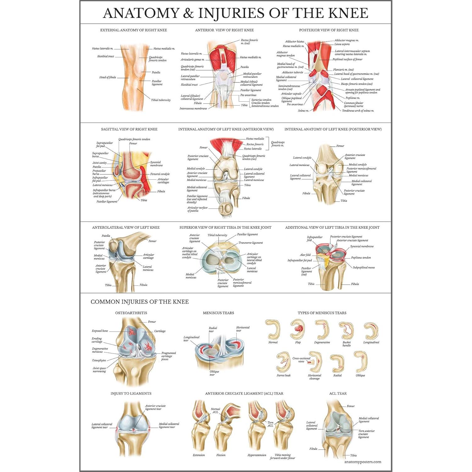 Conjunto de Pósters de Anatomía Rodilla y Cadera - Palace Learning - Laminado 68.58x45.72 cm
