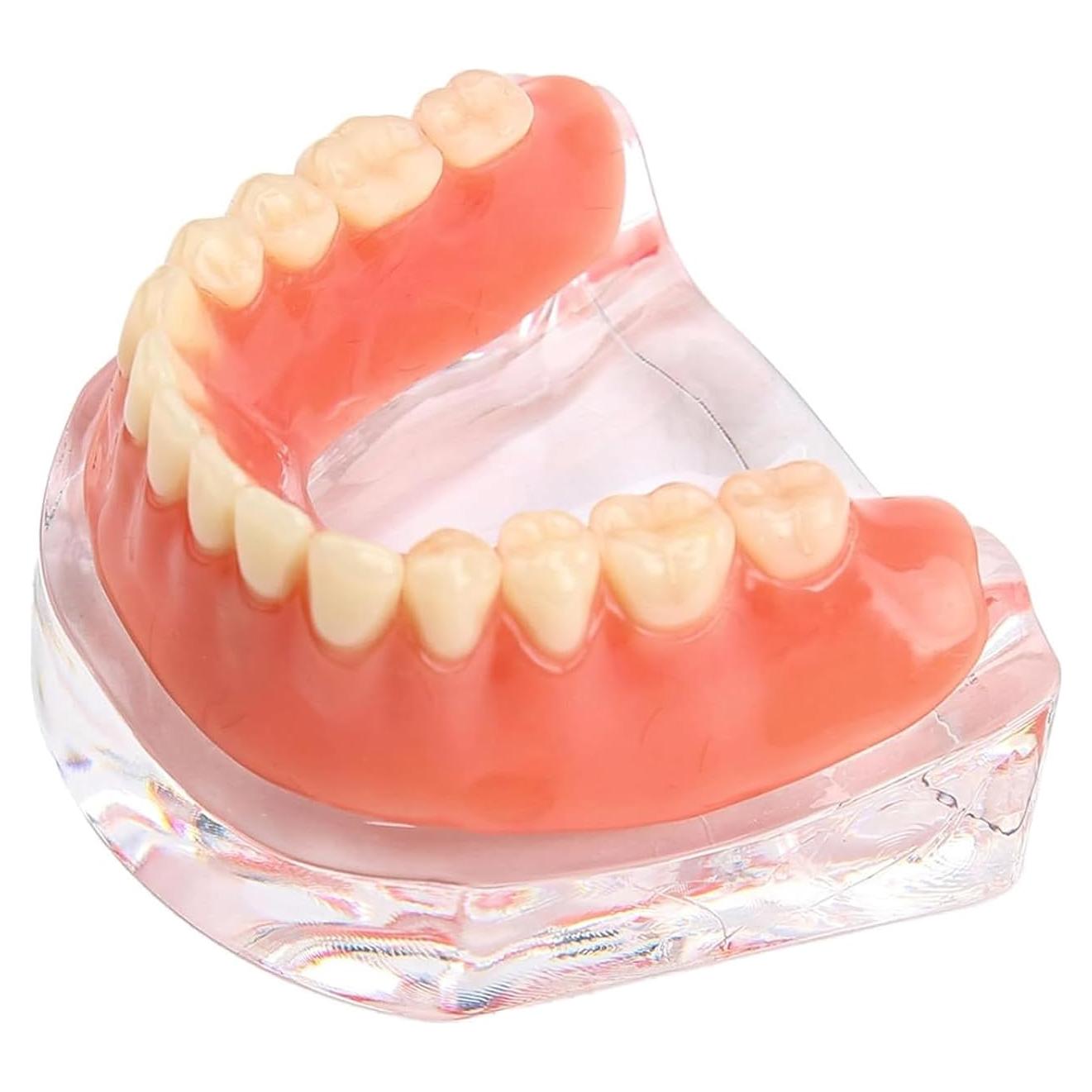 Modelo Dental Sobredentadura Desmontable Kouyot - Mandíbula Inferior