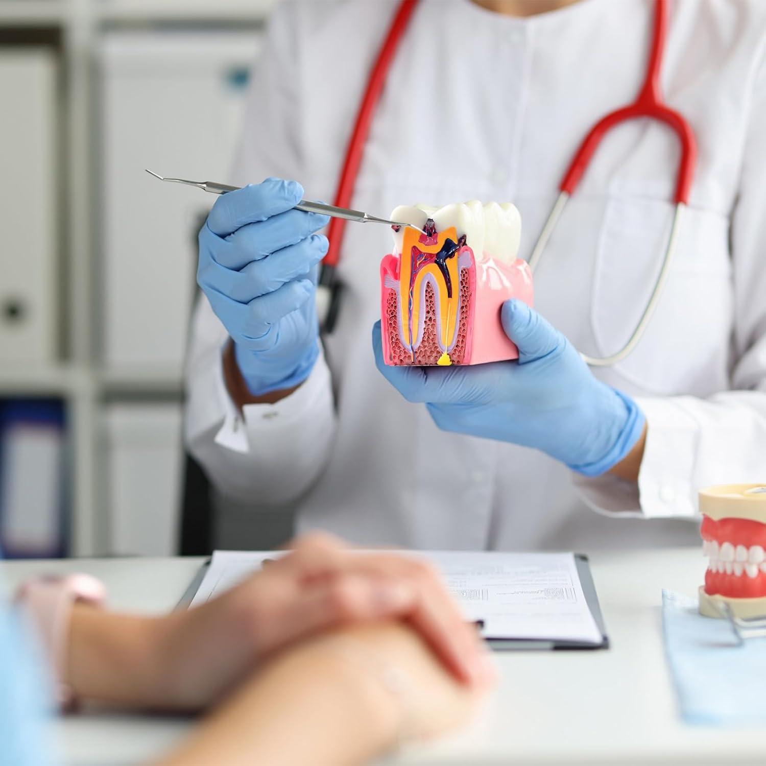 Modelo Educativo de Dientes de Caries Ceonam 8.6x7.6cm