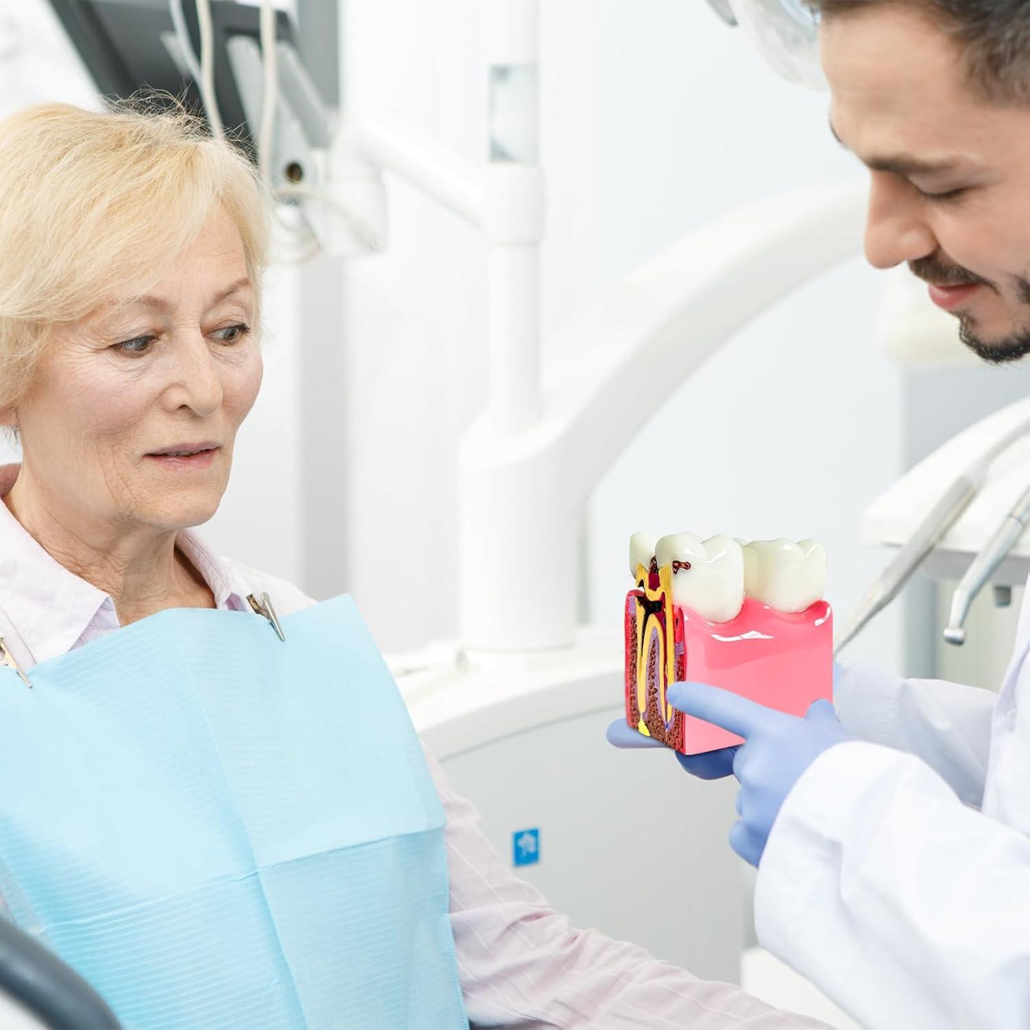 Modelo Educativo de Dientes de Caries Ceonam 8.6x7.6cm