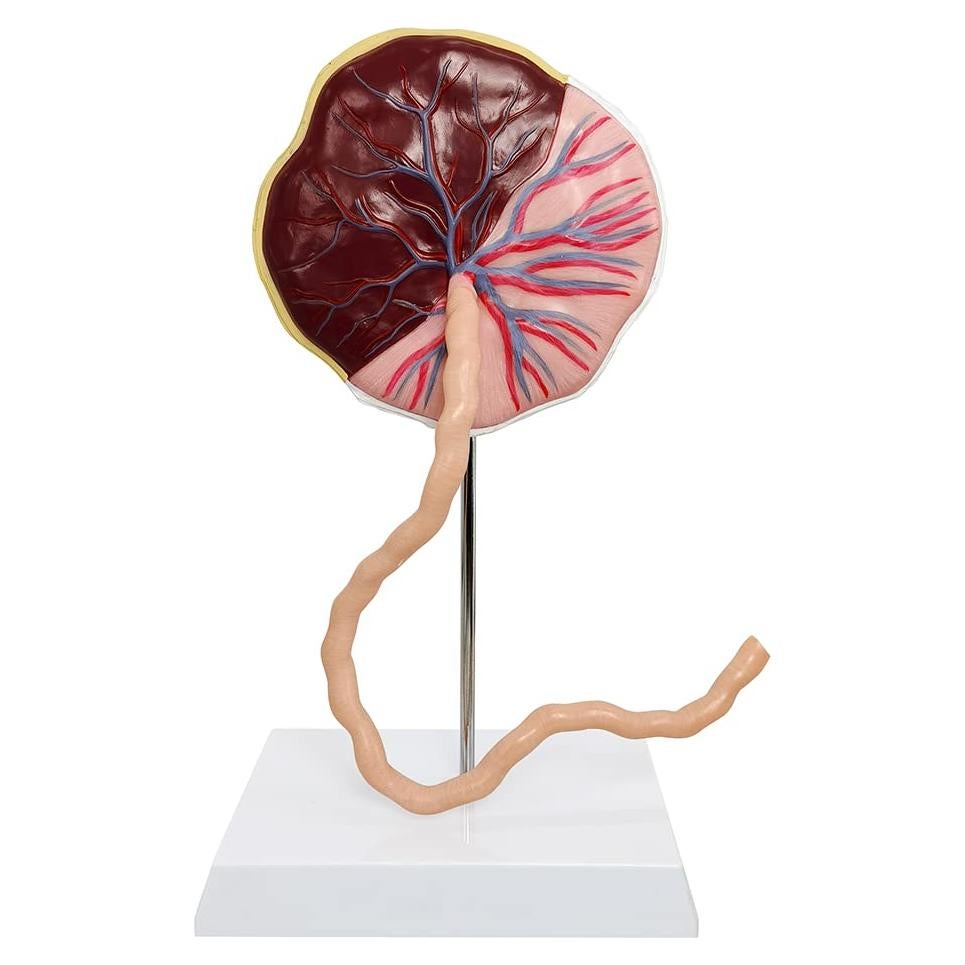 Modelo Anatómico de Placenta Benilev con Cordón Umbilical