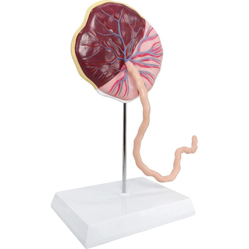 Modelo Anatómico de Placenta Benilev con Cordón Umbilical