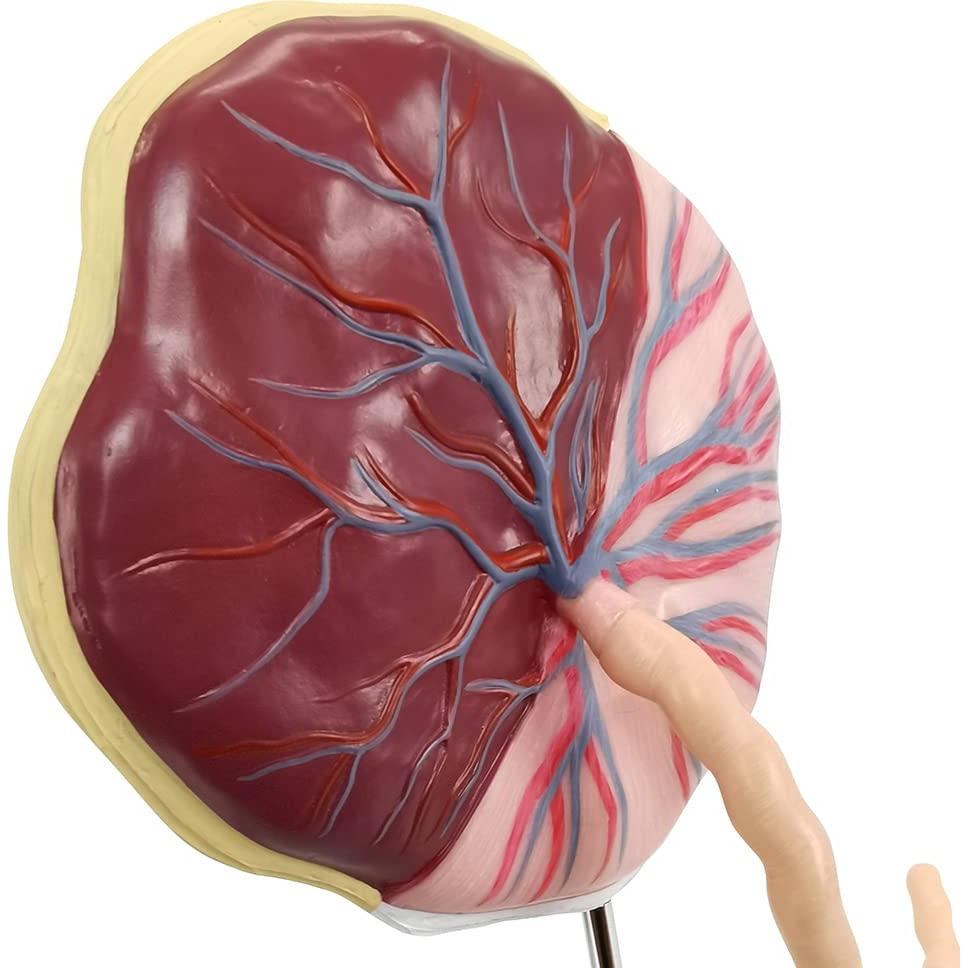 Modelo Anatómico de Placenta Benilev con Cordón Umbilical