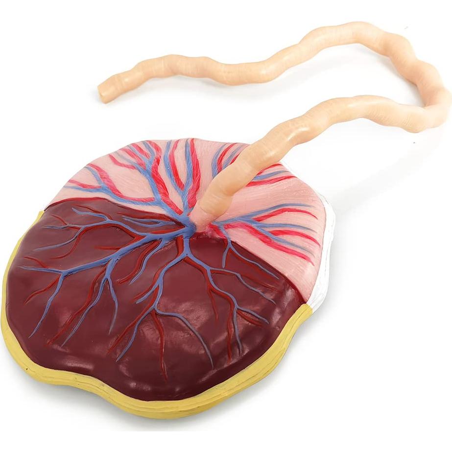 Modelo Anatómico de Placenta Benilev con Cordón Umbilical