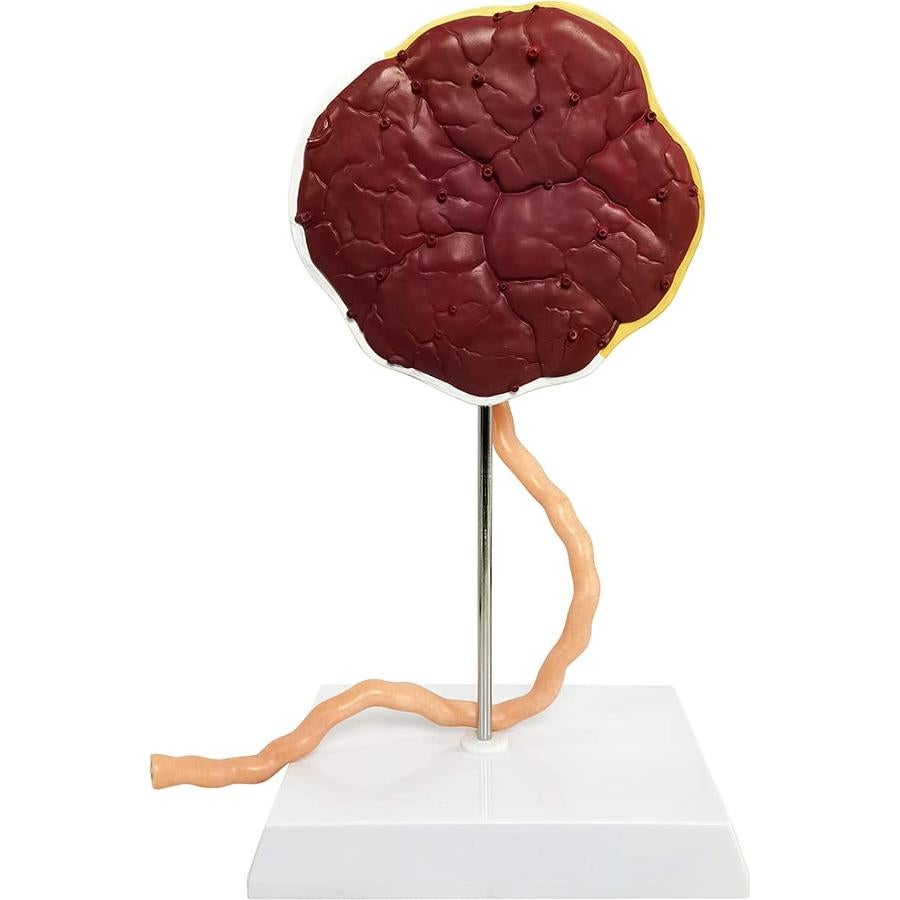 Modelo Anatómico de Placenta Benilev con Cordón Umbilical