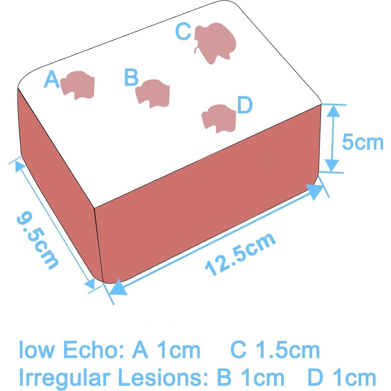 Modelo de Punción Ultrasónica SZEMENTMD para Biopsia Linfática