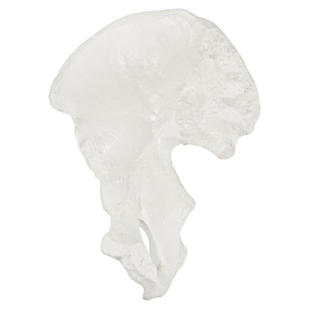 Modelo de Hueso de Cadera Derecho Axis Scientific - Realista